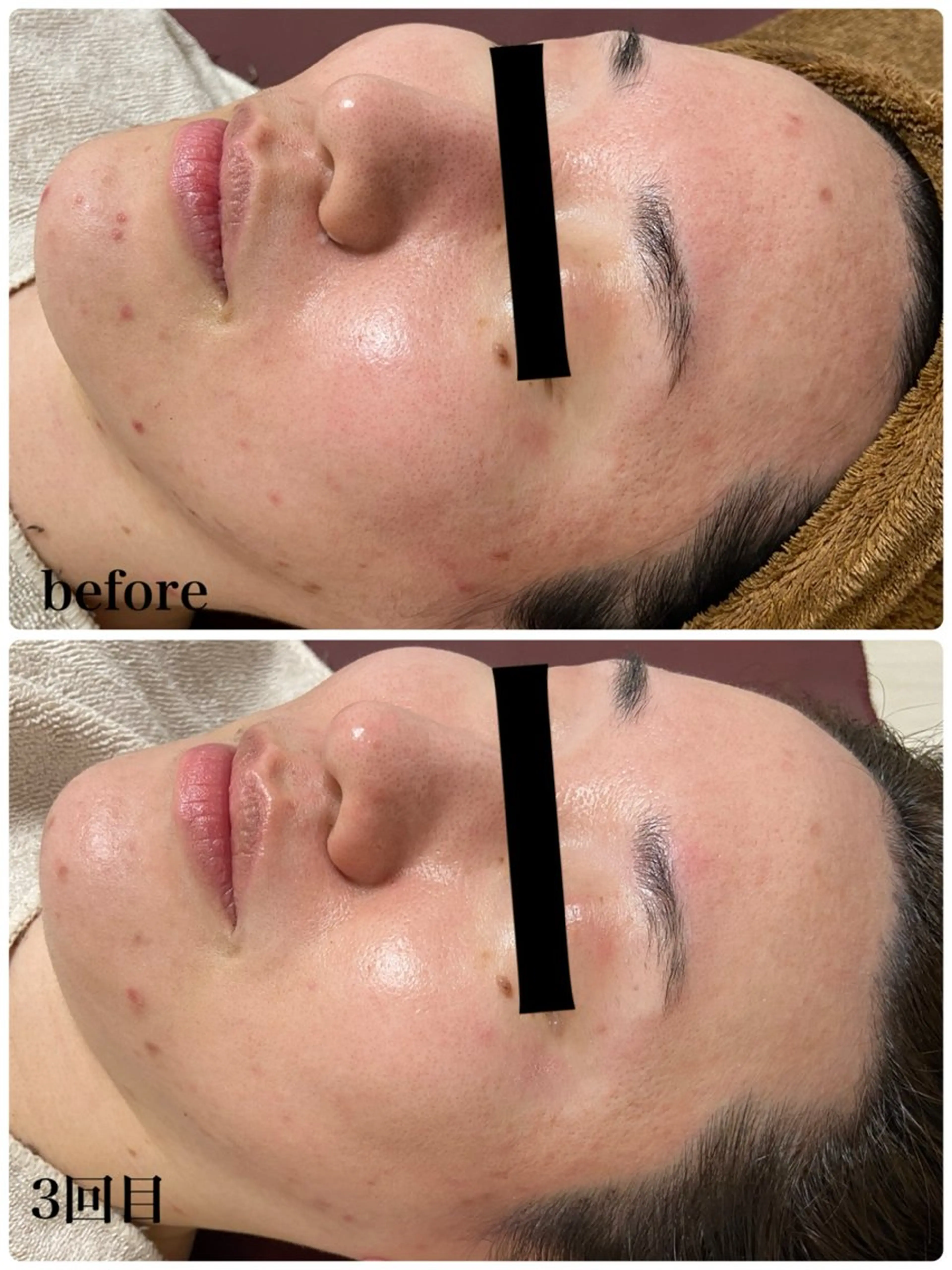 エステ REBORN by ami-goのその他イメージ