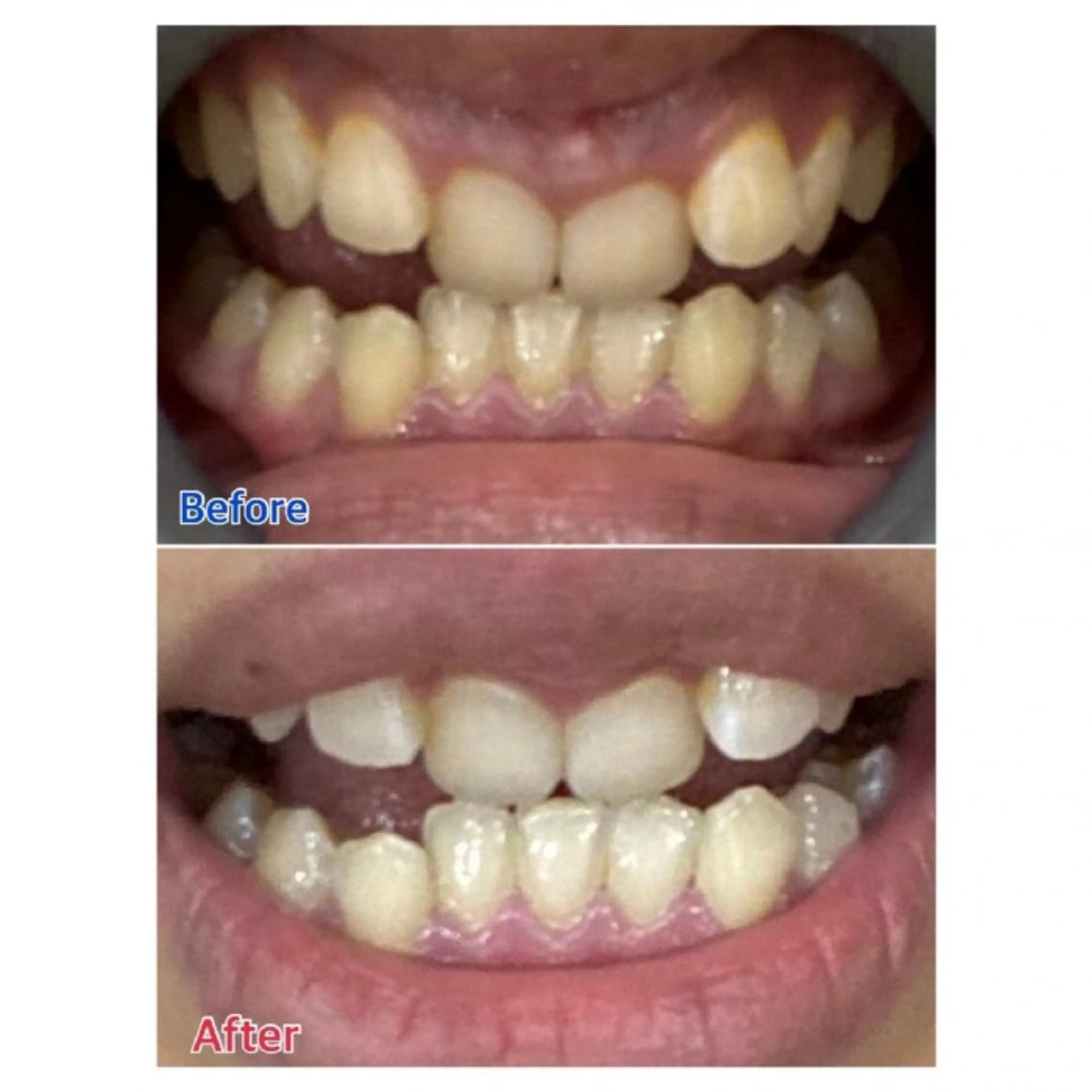 M渋谷店所属・Ｍ渋谷 ホワイトニングのその他イメージ