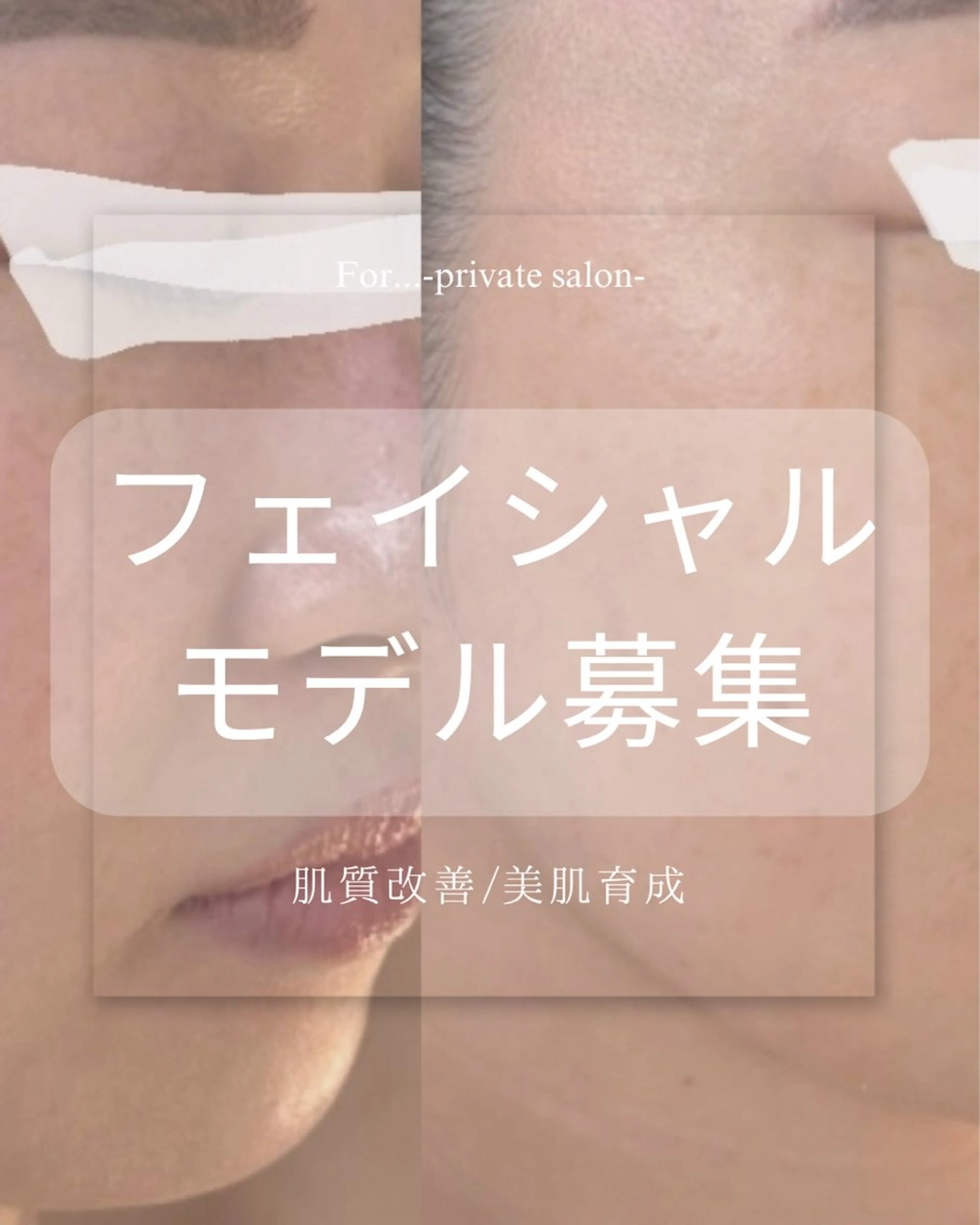 🫧【モデル募集】肌質改善ケア×素肌美人に🪽40分(クレンジング→悩み別ピーリング→マスク→仕上げ)の写真