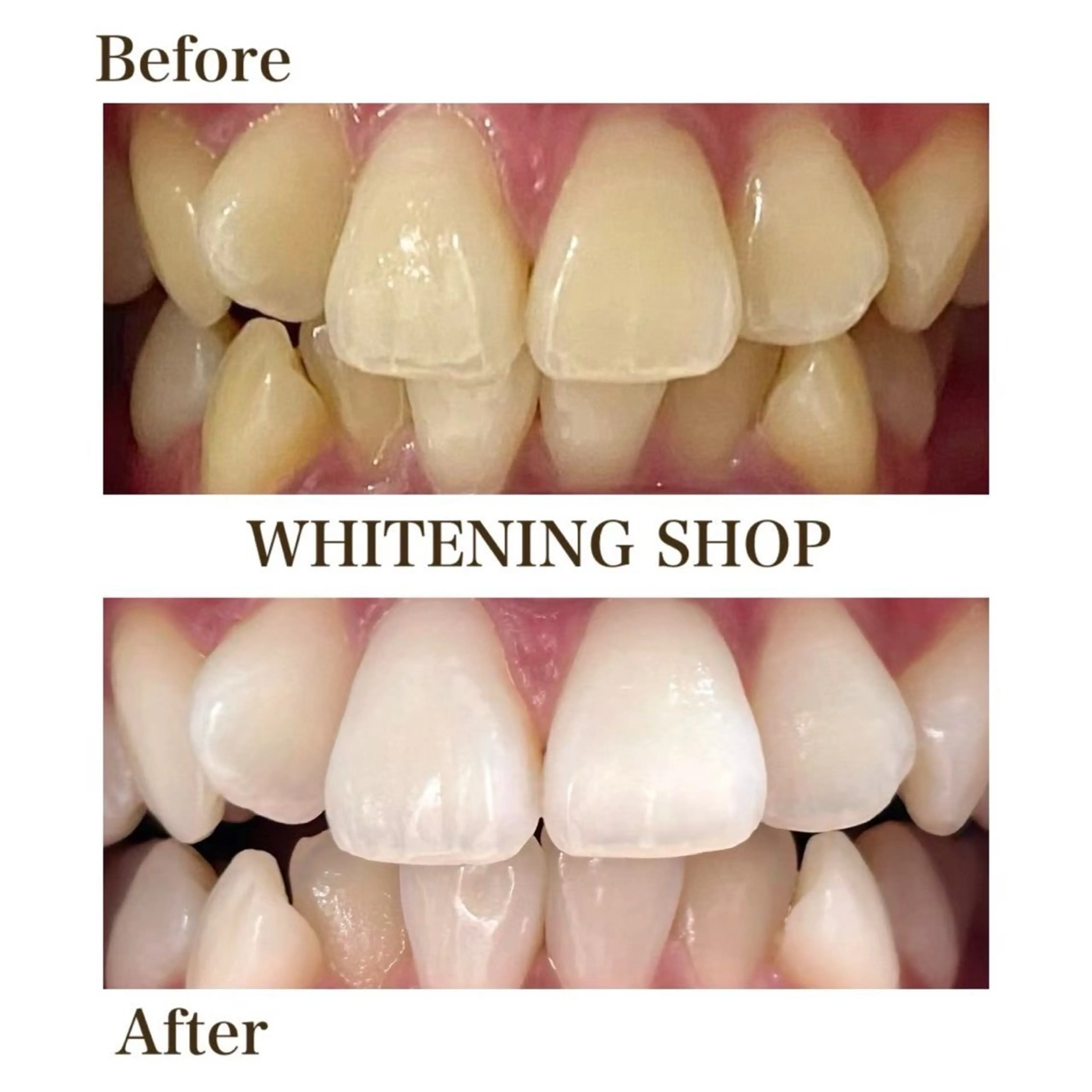 メンズ ホワイトニングショップ静岡葵区店所属・ホワイトニング ショップ葵区静岡駅店のその他イメージ