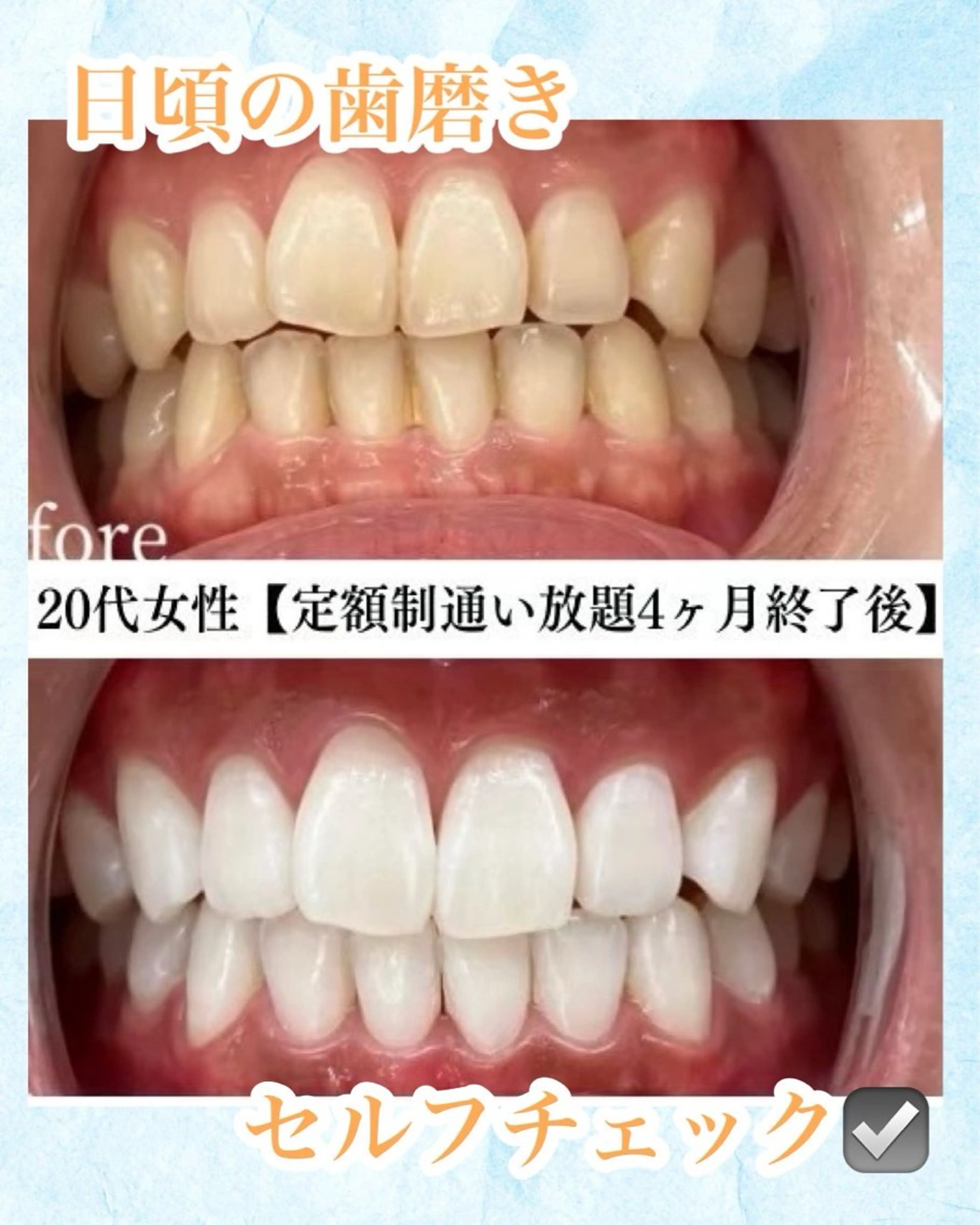 メンズ キッズ ホワイトニング専門店 WHITE天神店のエステ・リラクイメージ