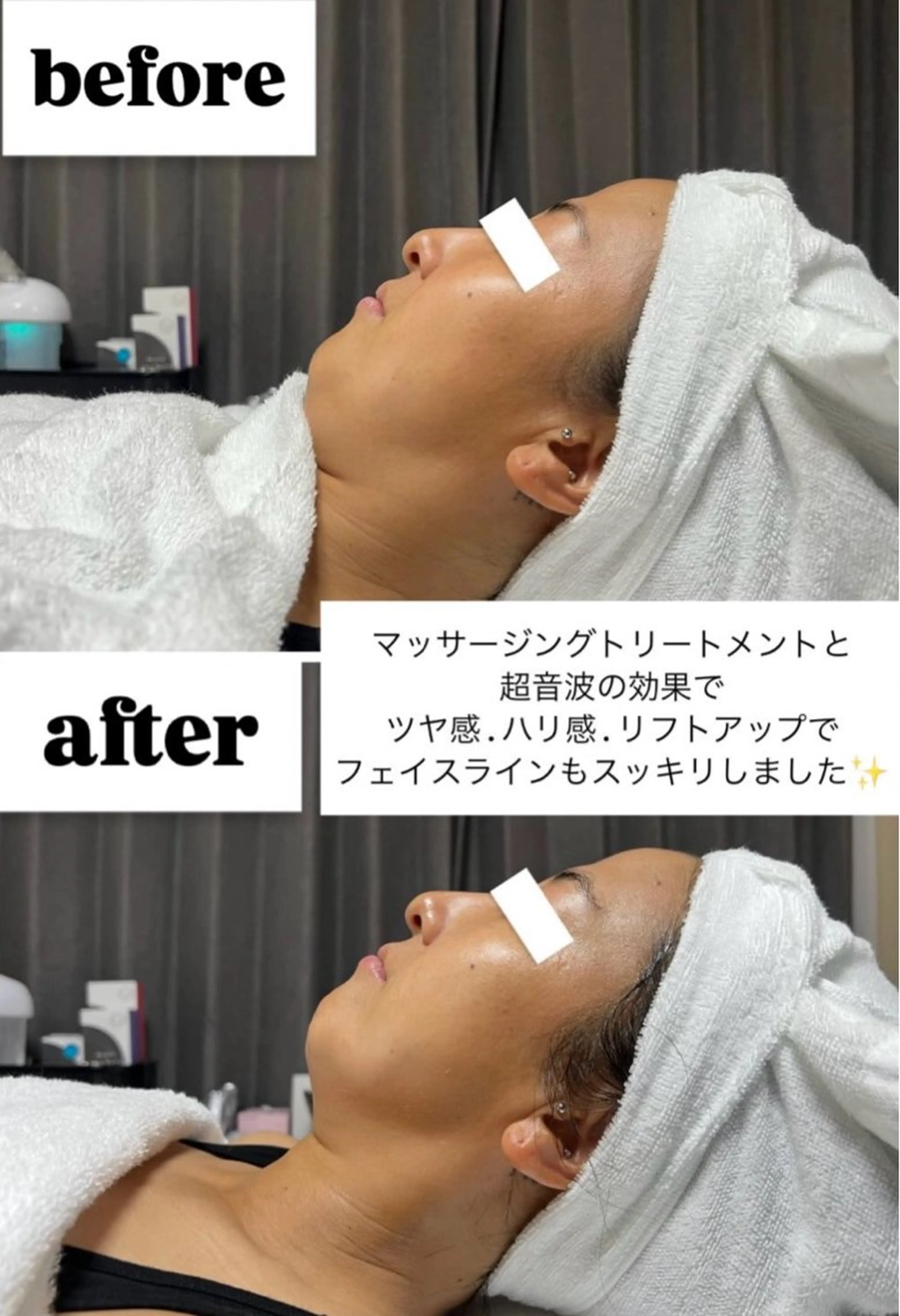 エステ ROR Akariのエステ・リラクイメージ