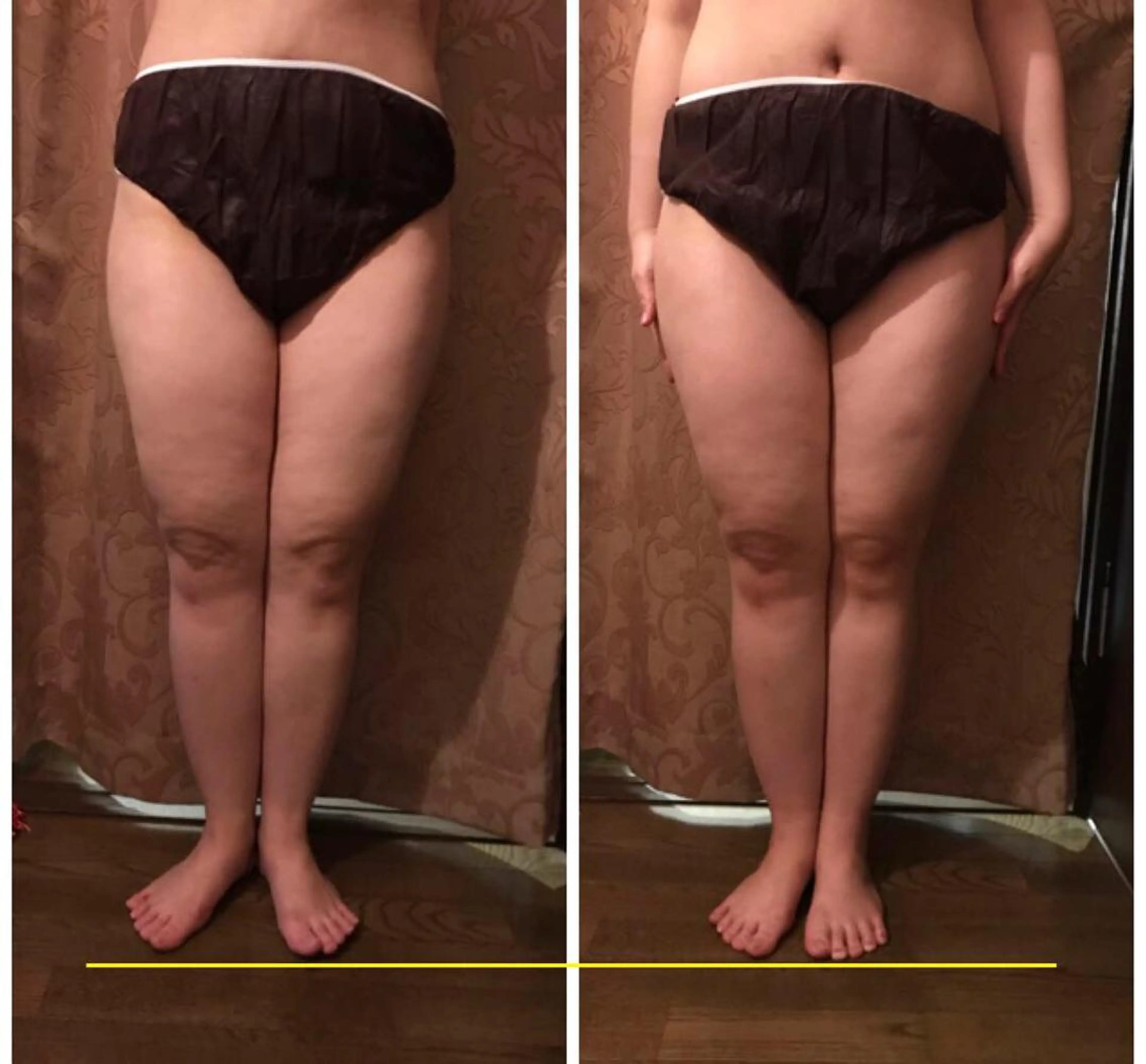 代表 MOMOのエステ・リラクイメージ