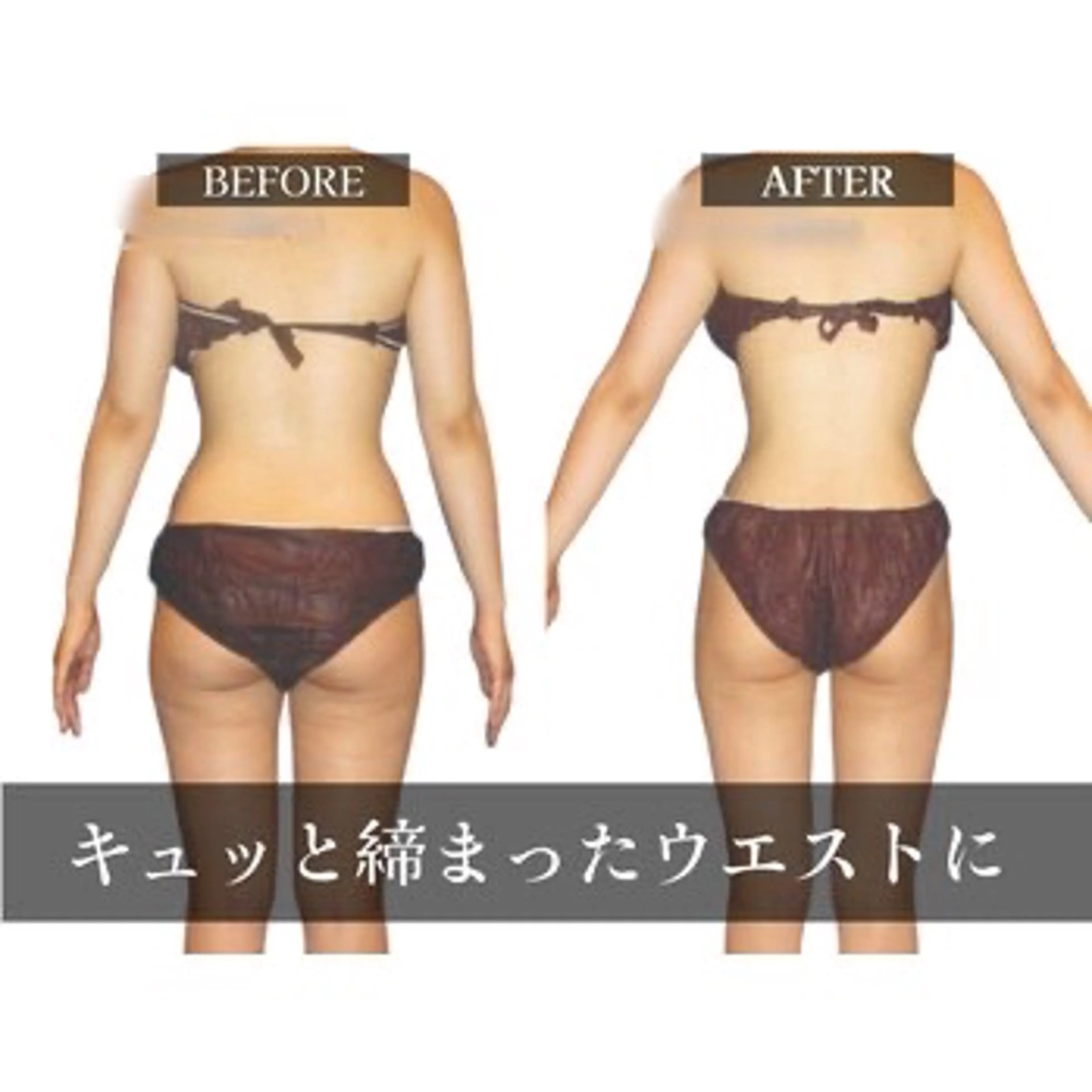 エステ Julien千葉店所属・痩身エステ✨ Julien千葉店✨のエステ・リラクイメージ