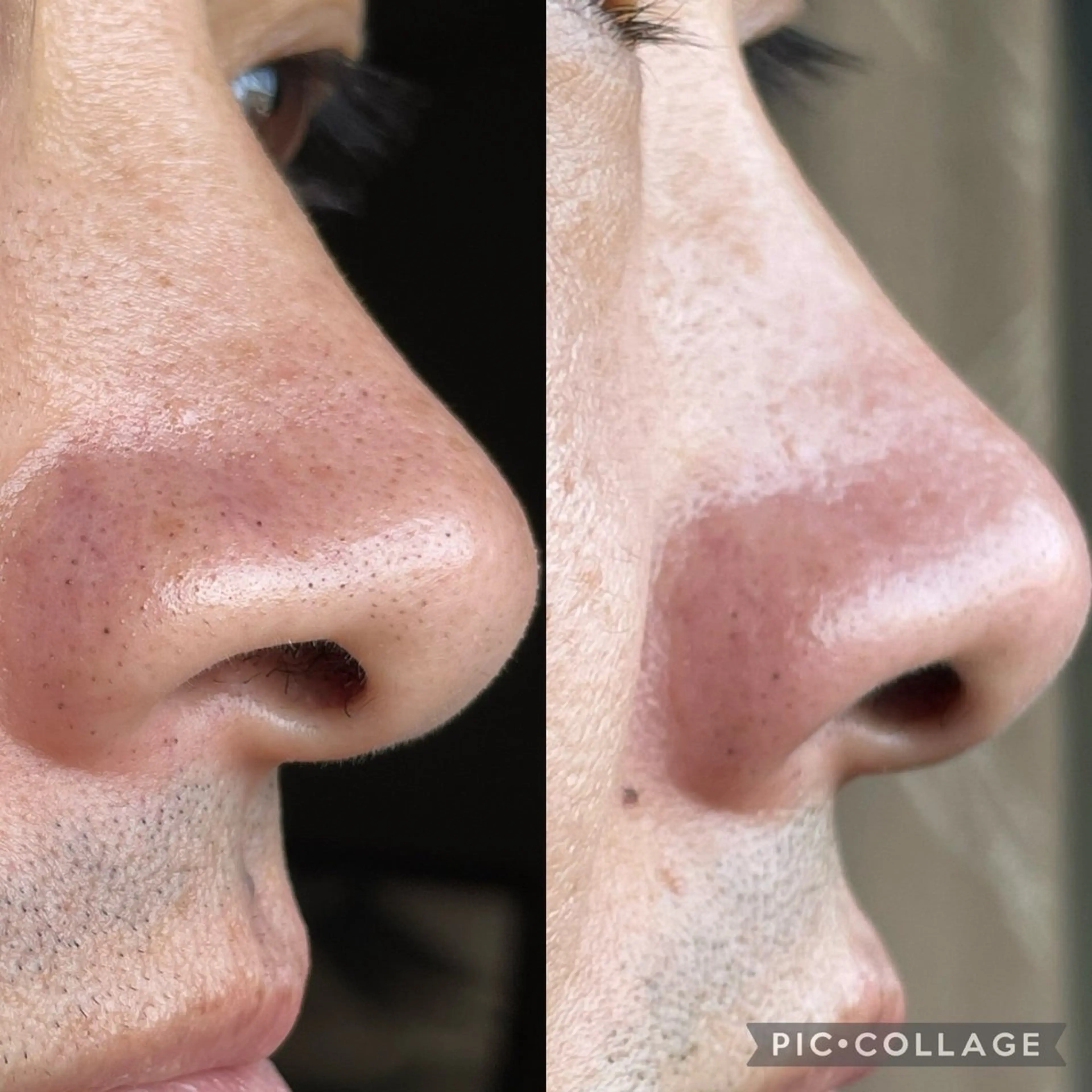 メンズ エステ 美Face所属・美 Faceのエステ・リラクイメージ