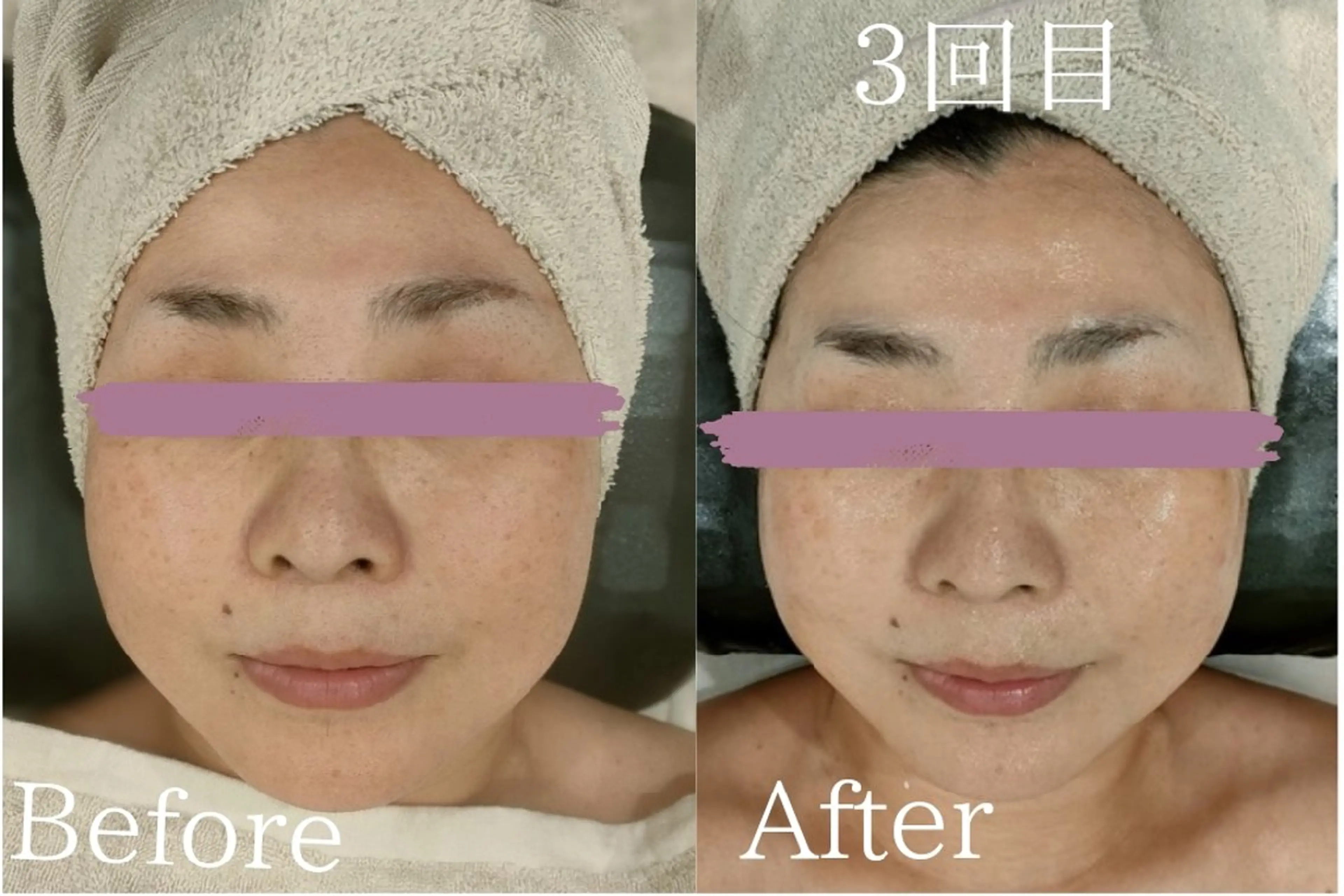 エステ 美肌脱毛＆小顔・フェ イシャル【SONA】のエステ・リラクイメージ