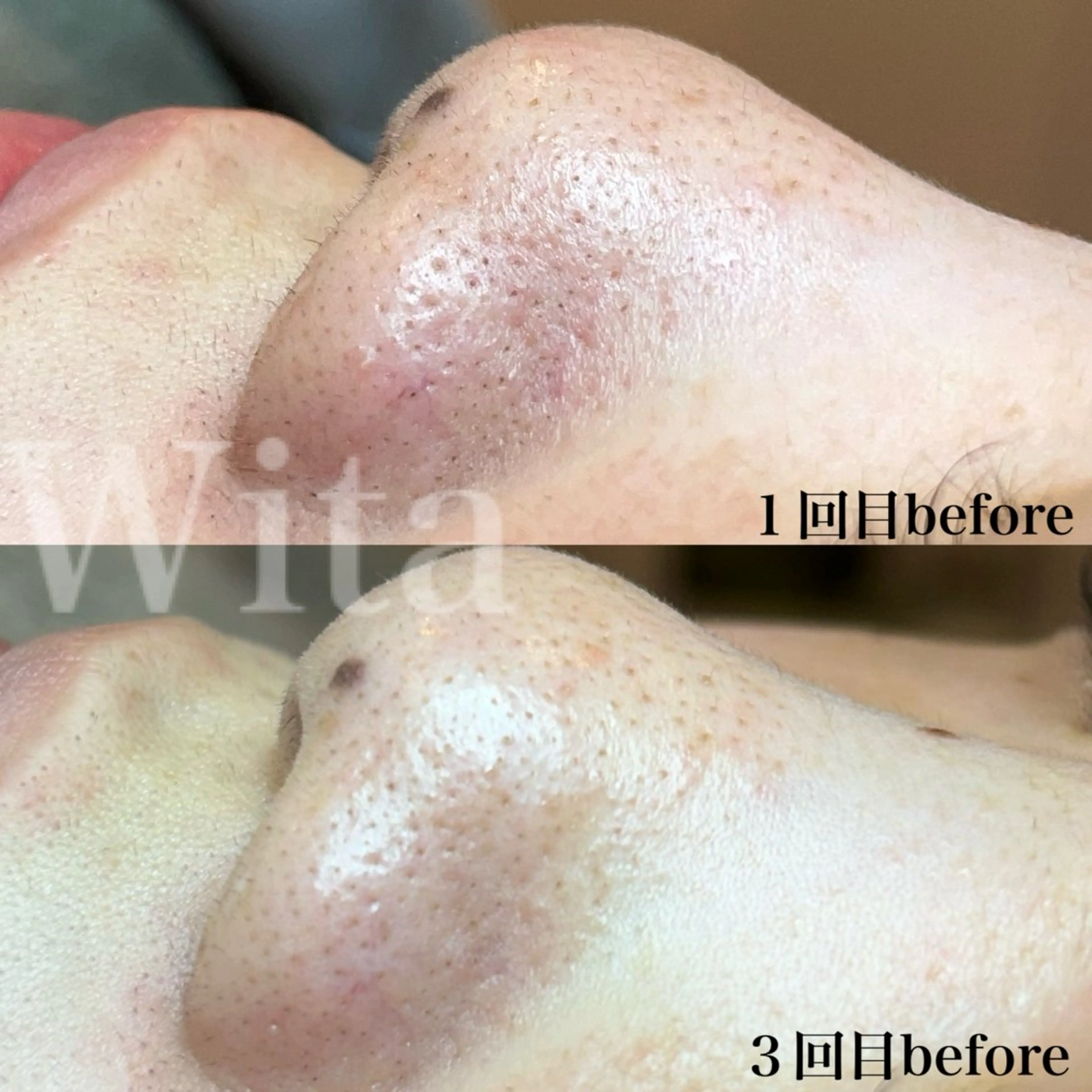 エステ Wita aesthetic×eyelash所属・上坂 祐以のエステ・リラクイメージ