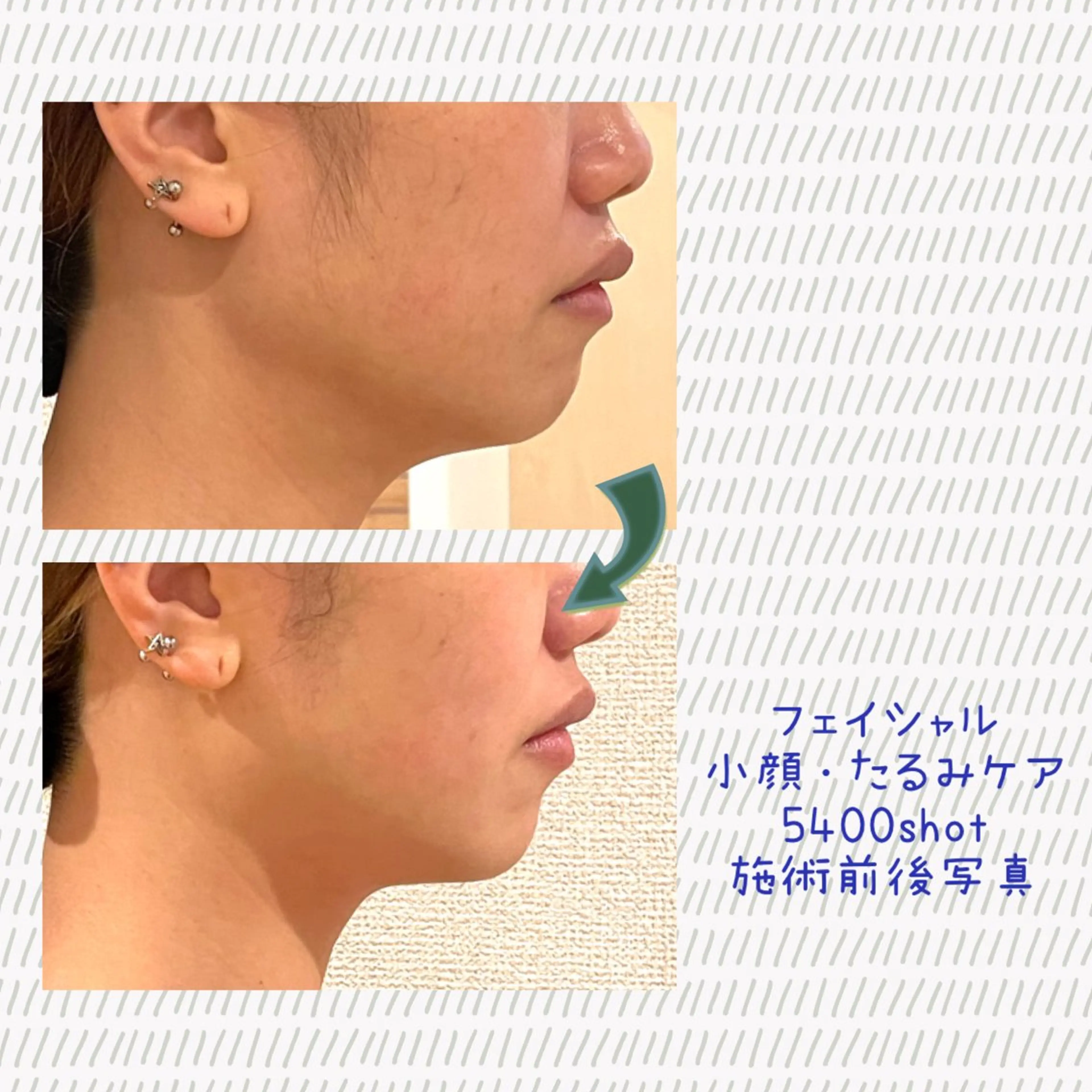 Laplace池袋本店(ラプラス池袋本店)所属・Laplace 池袋本店のその他イメージ