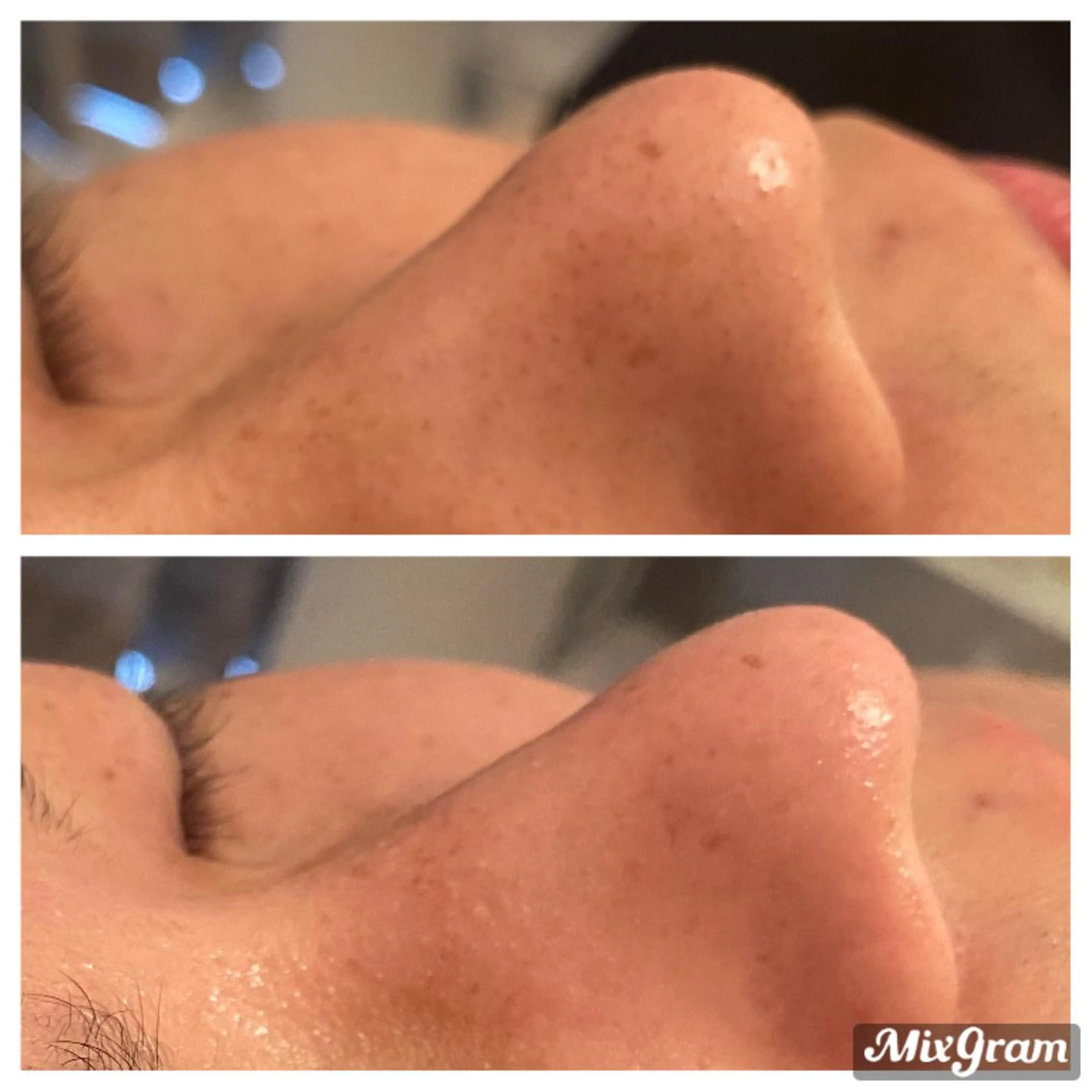 Remina clinical salon所属・ハイフ美肌専門 Remina.c.sのエステ・リラクイメージ