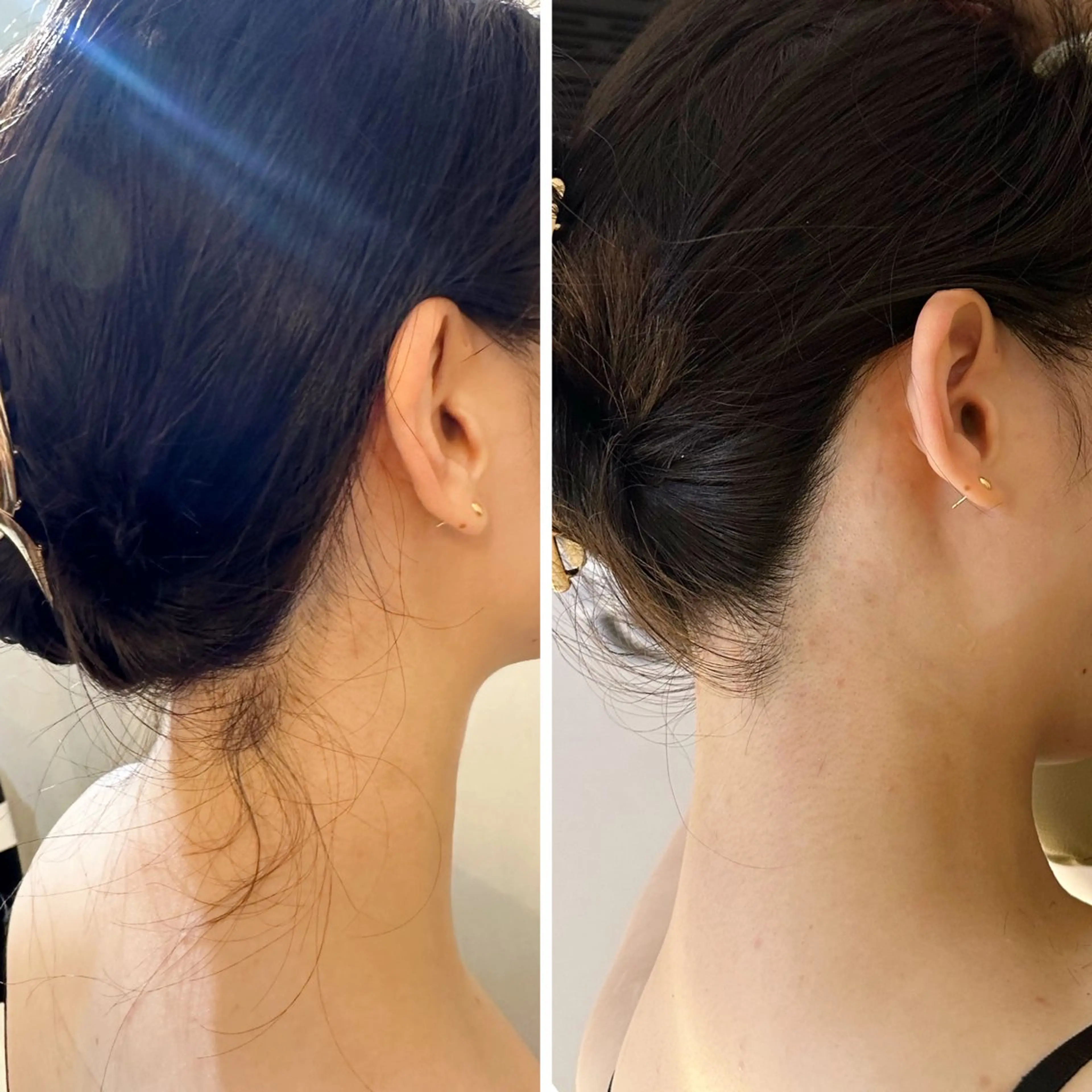 脱毛 うなじ脱毛/美肌脱毛 LABELのエステ・リラクイメージ