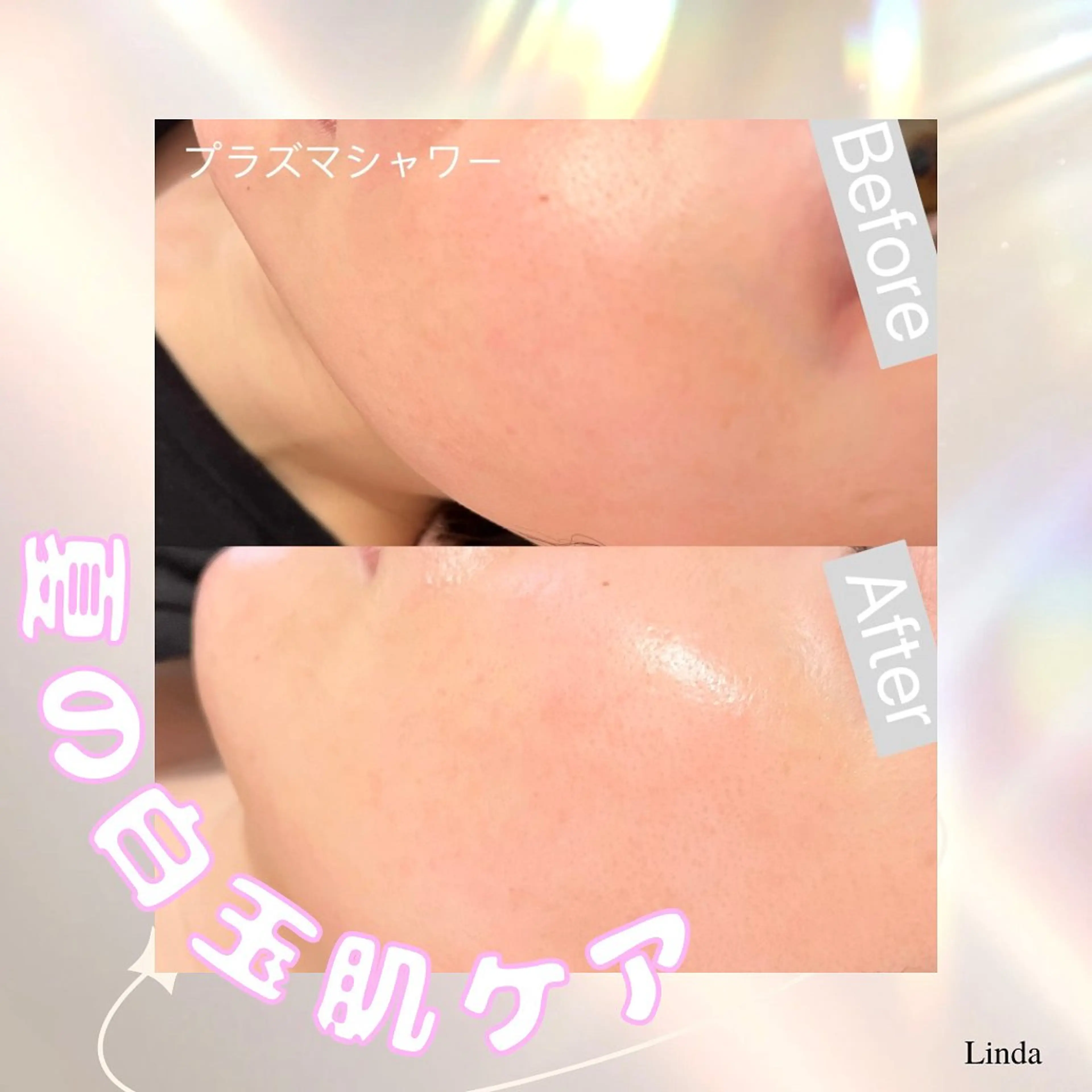 エステ アイラッシュ&エステサロンLinda西宮所属・小顔&毛穴・肌質改善 LINDA西宮 AIのエステ・リラクイメージ