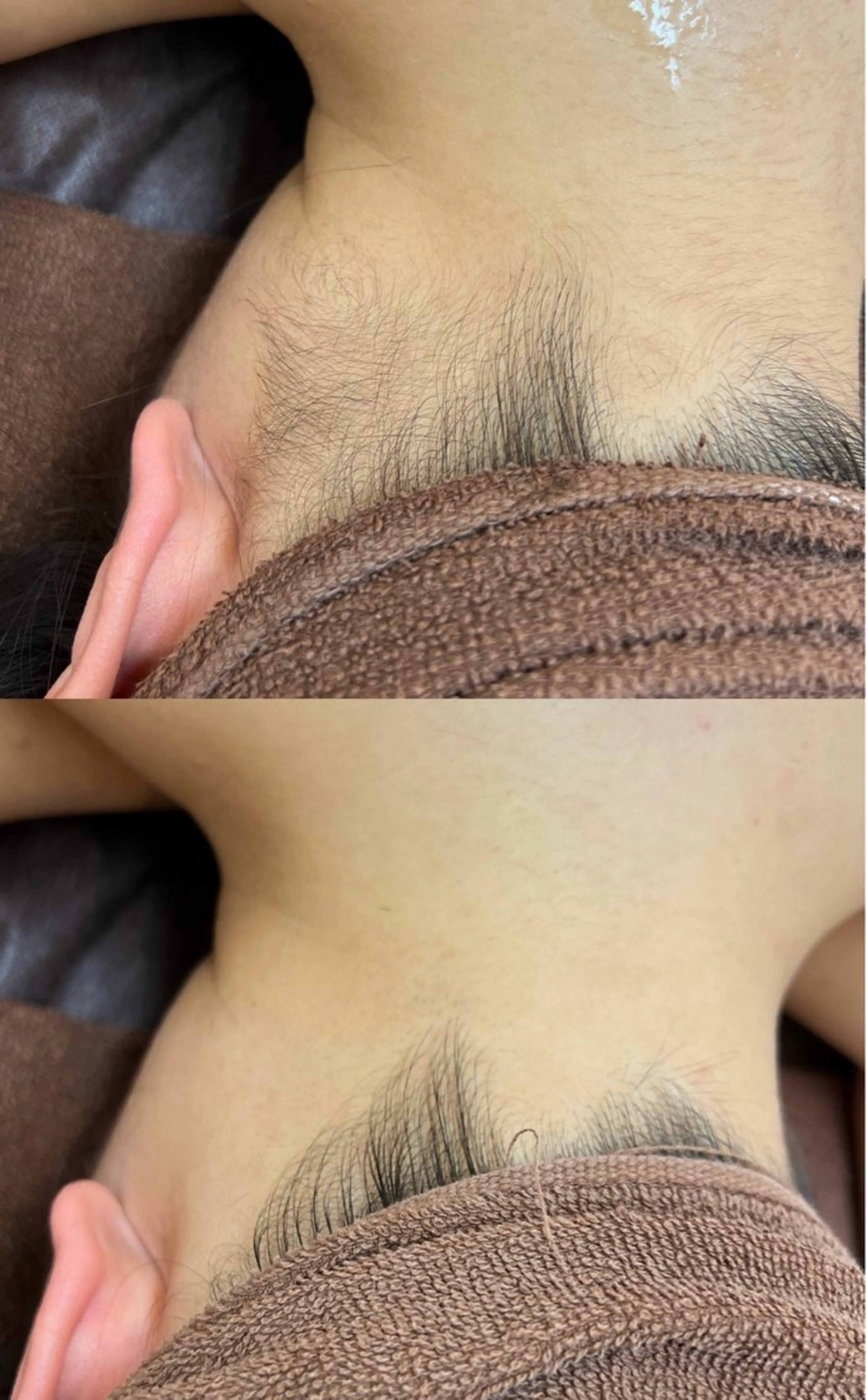 脱毛 プライベートサロン リプレイスのエステ・リラクイメージ