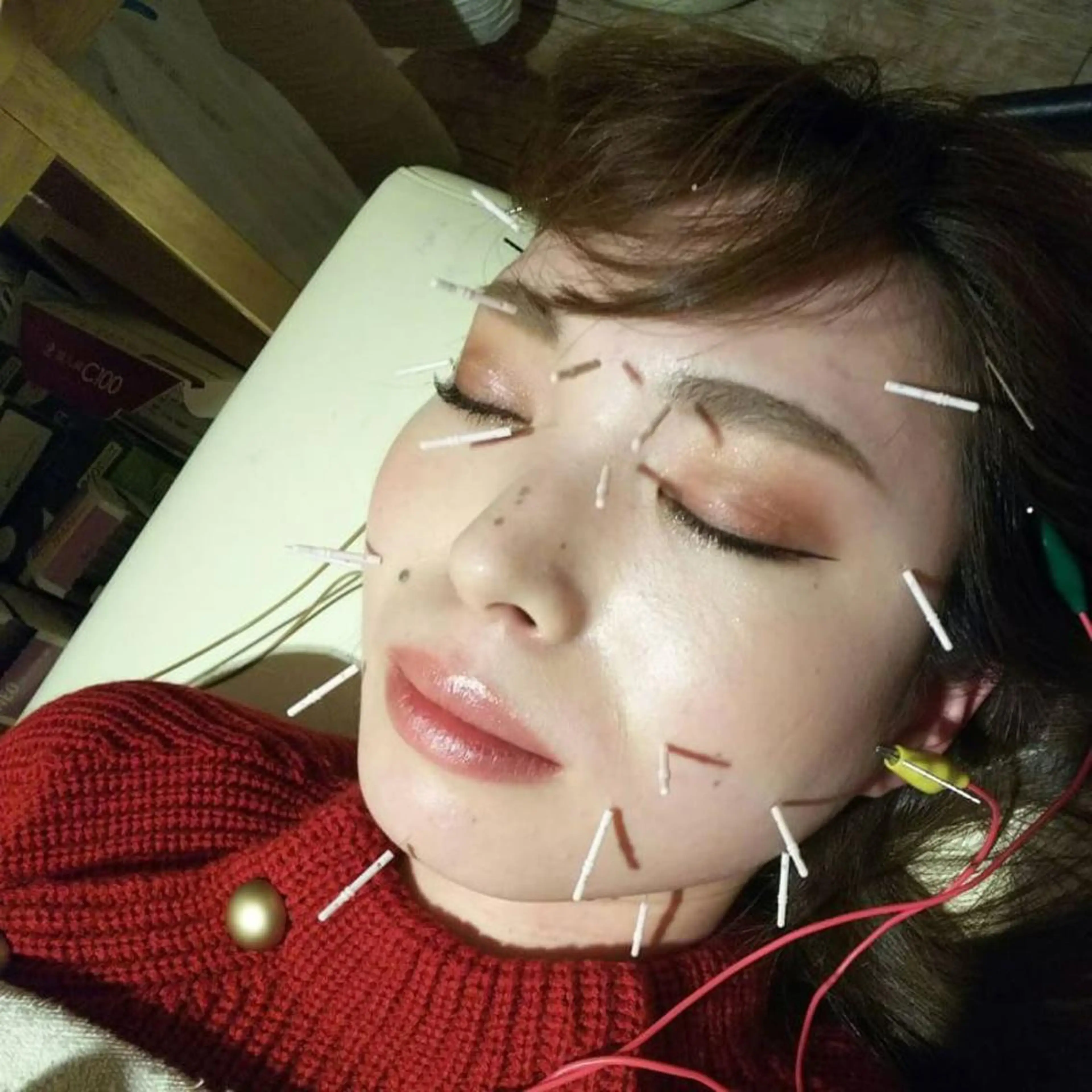 むくみたるみ専門☆ 美容鍼・小顔矯正のエステ・リラクイメージ