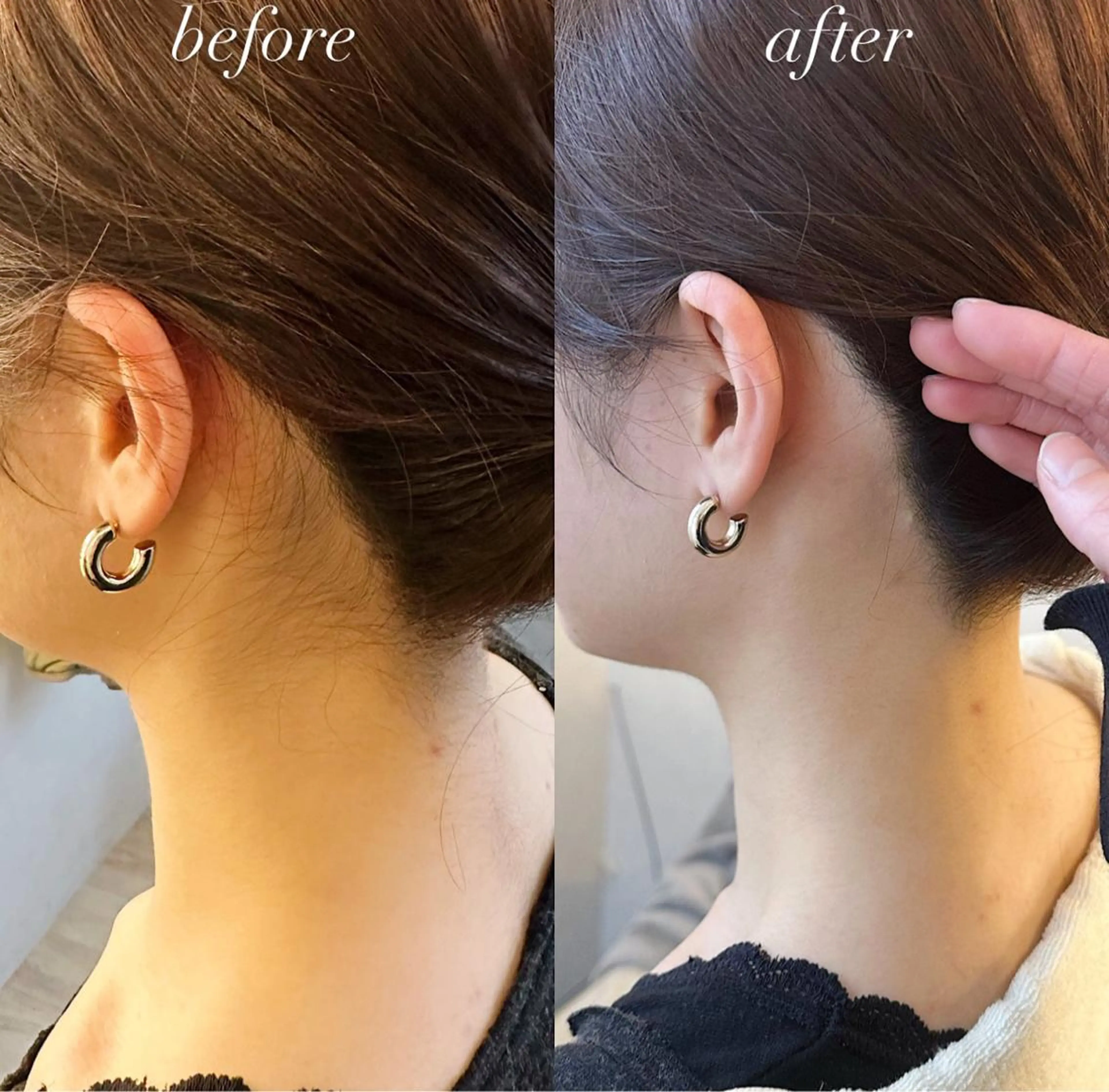 うなじ脱毛/美肌脱毛 LABELのエステ・リラクイメージ