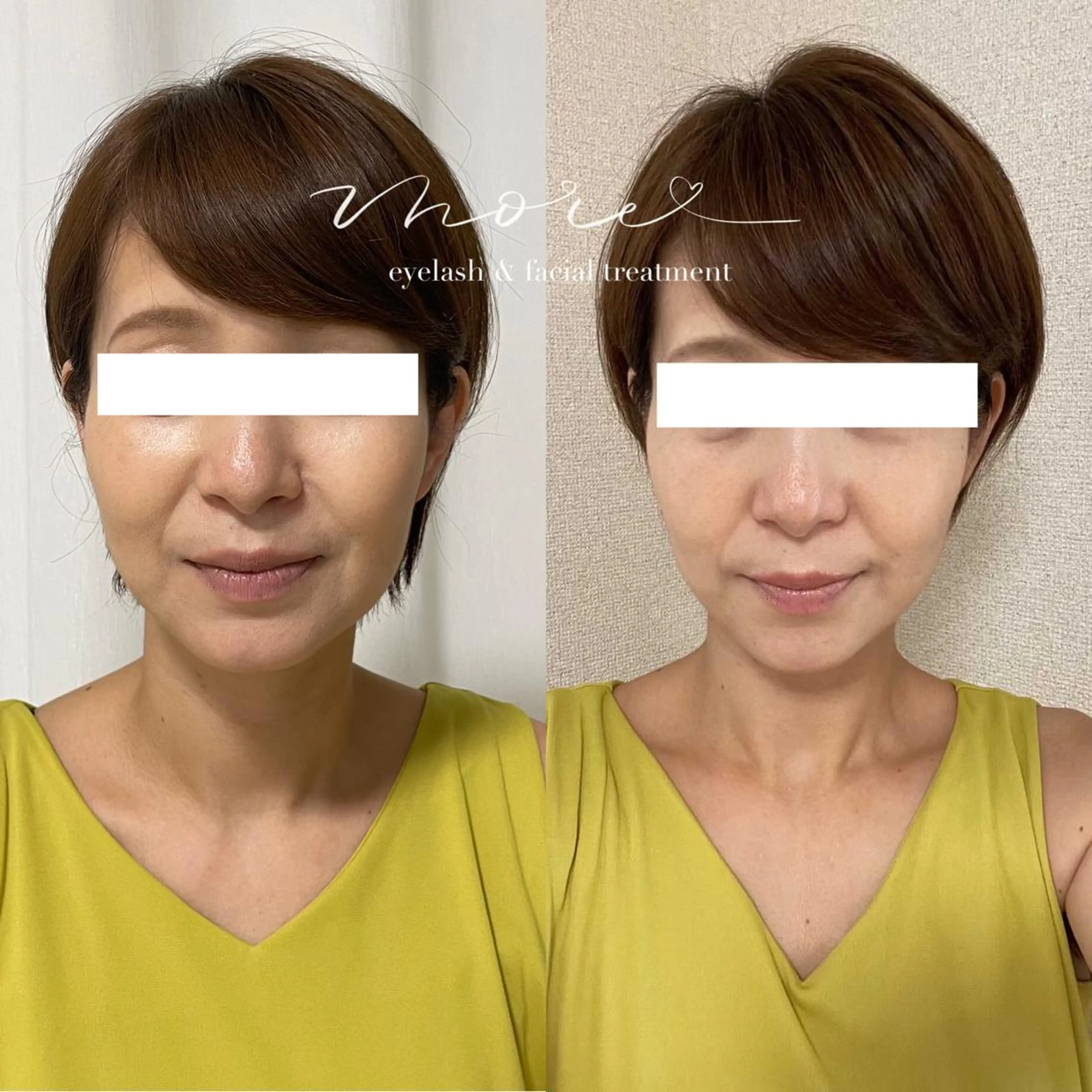 Eyelash salon MORE(モア)所属・安納 麻穂のエステ・リラクイメージ