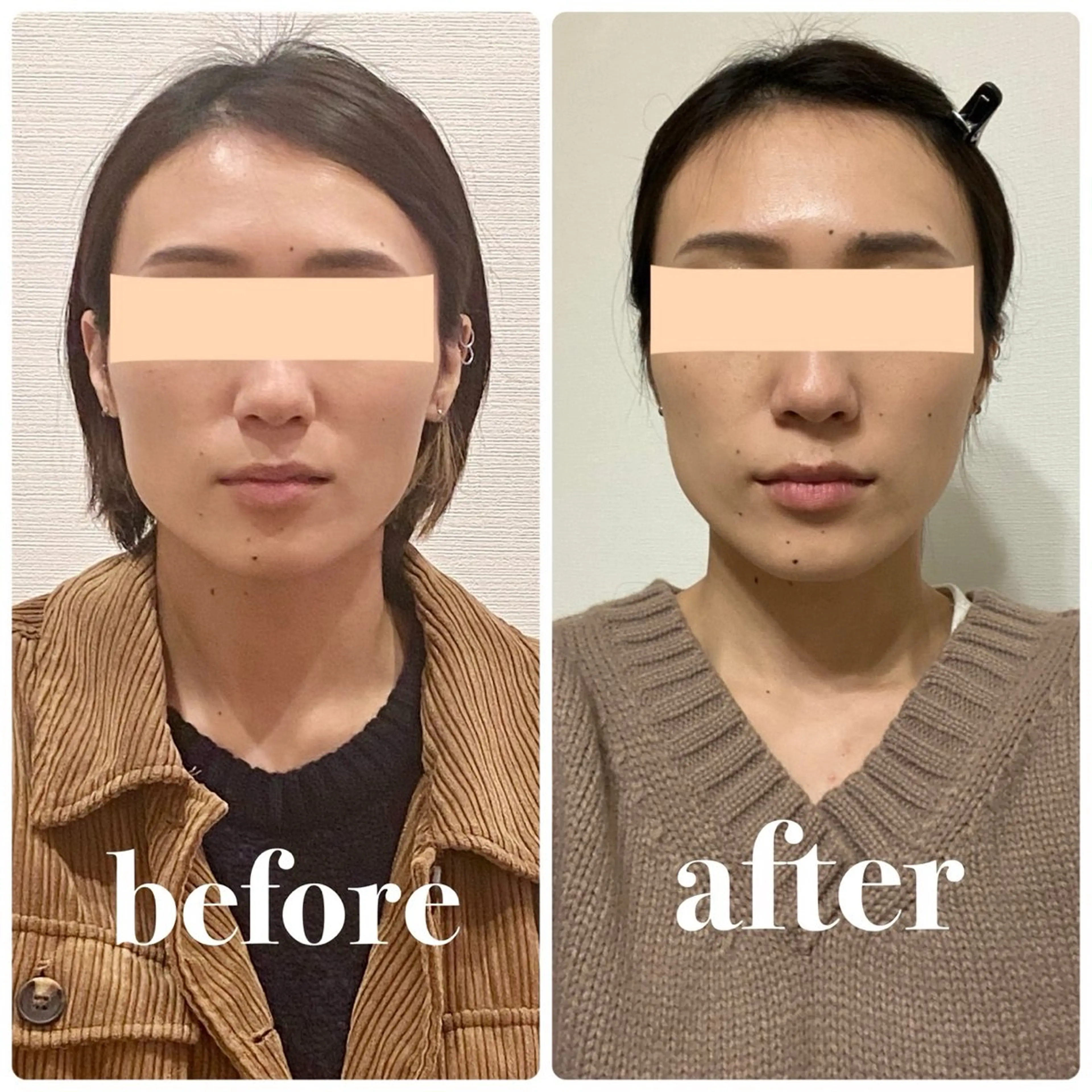 小顔矯正専門店Cream所属・菅野 もえのエステ・リラクイメージ