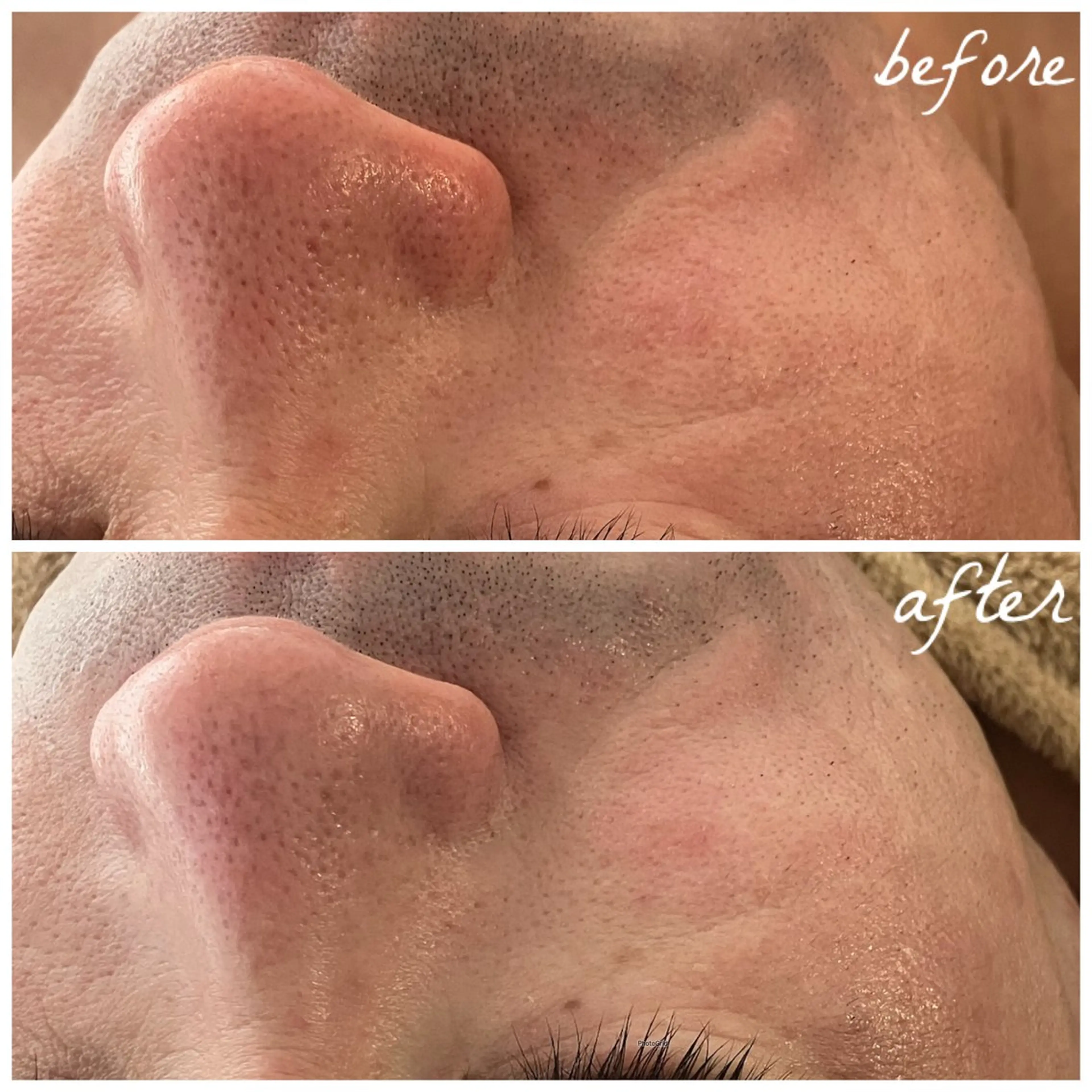 メンズ エステ メナード岐阜茜部 杉浦のエステ・リラクイメージ