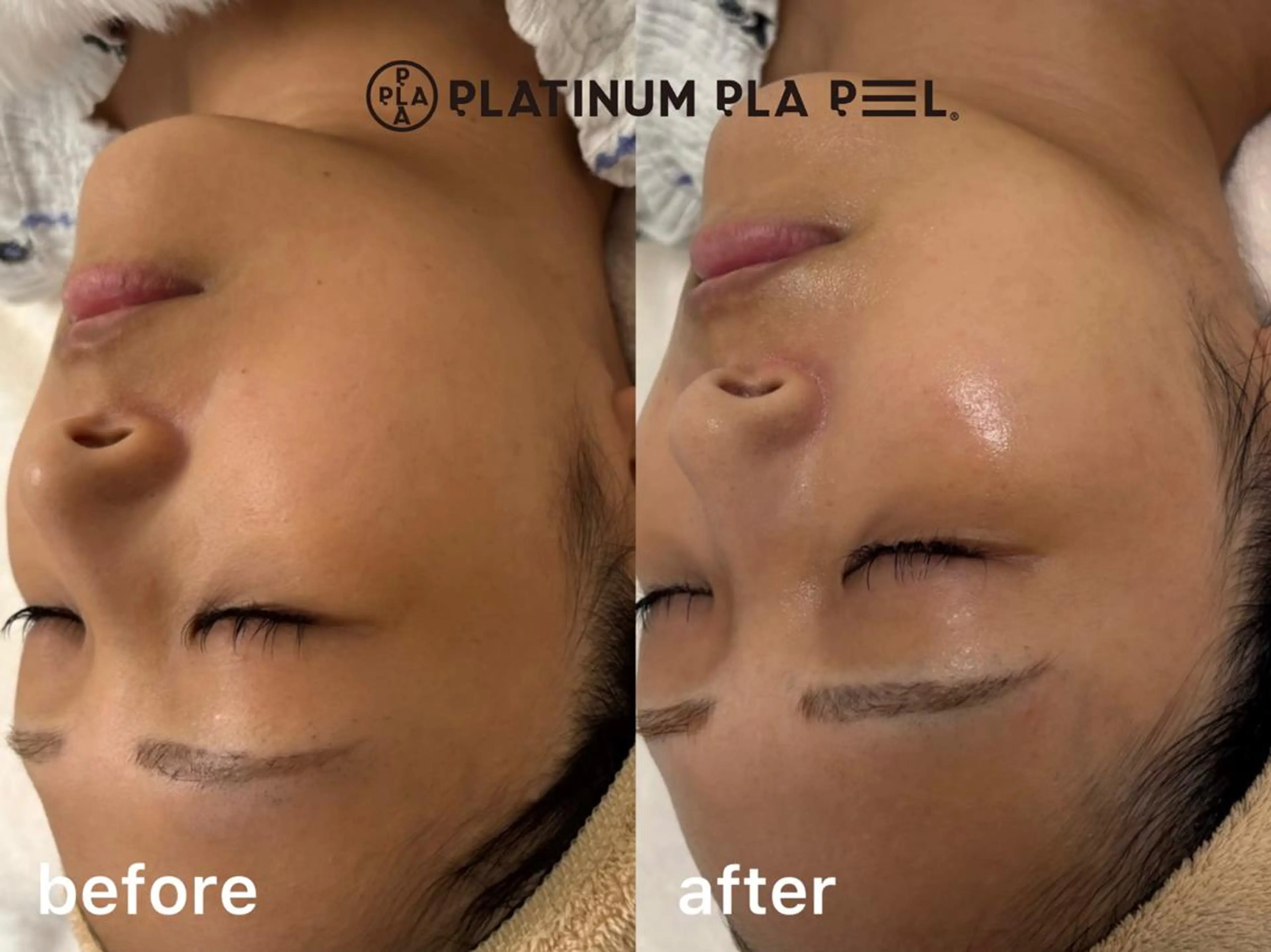 エステ リラク M FLOAT skin salonのエステ・リラクイメージ