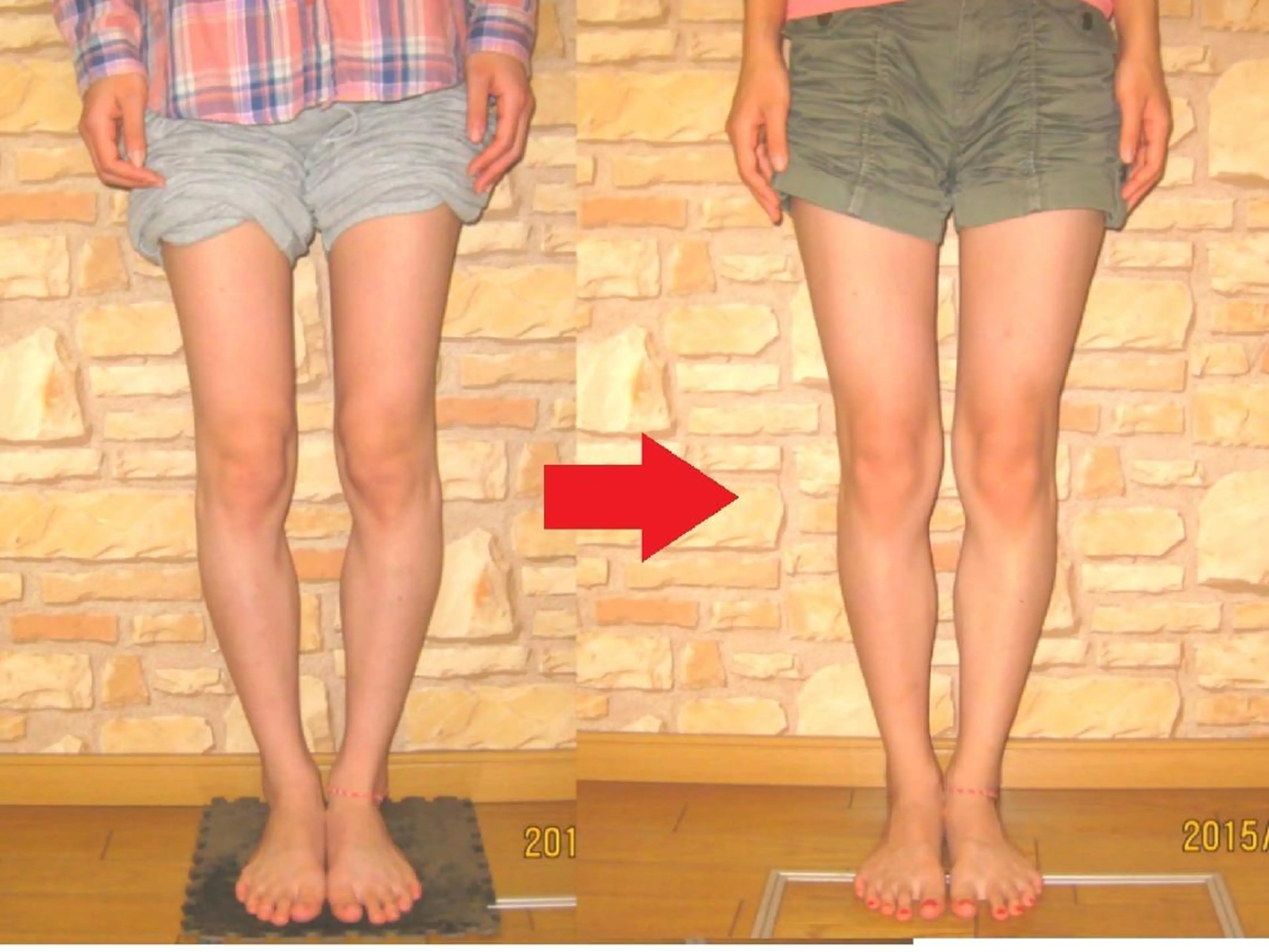 ゆがみ専門整体♪骨盤 姿勢 美脚✨清水貞利のエステ・リラクイメージ