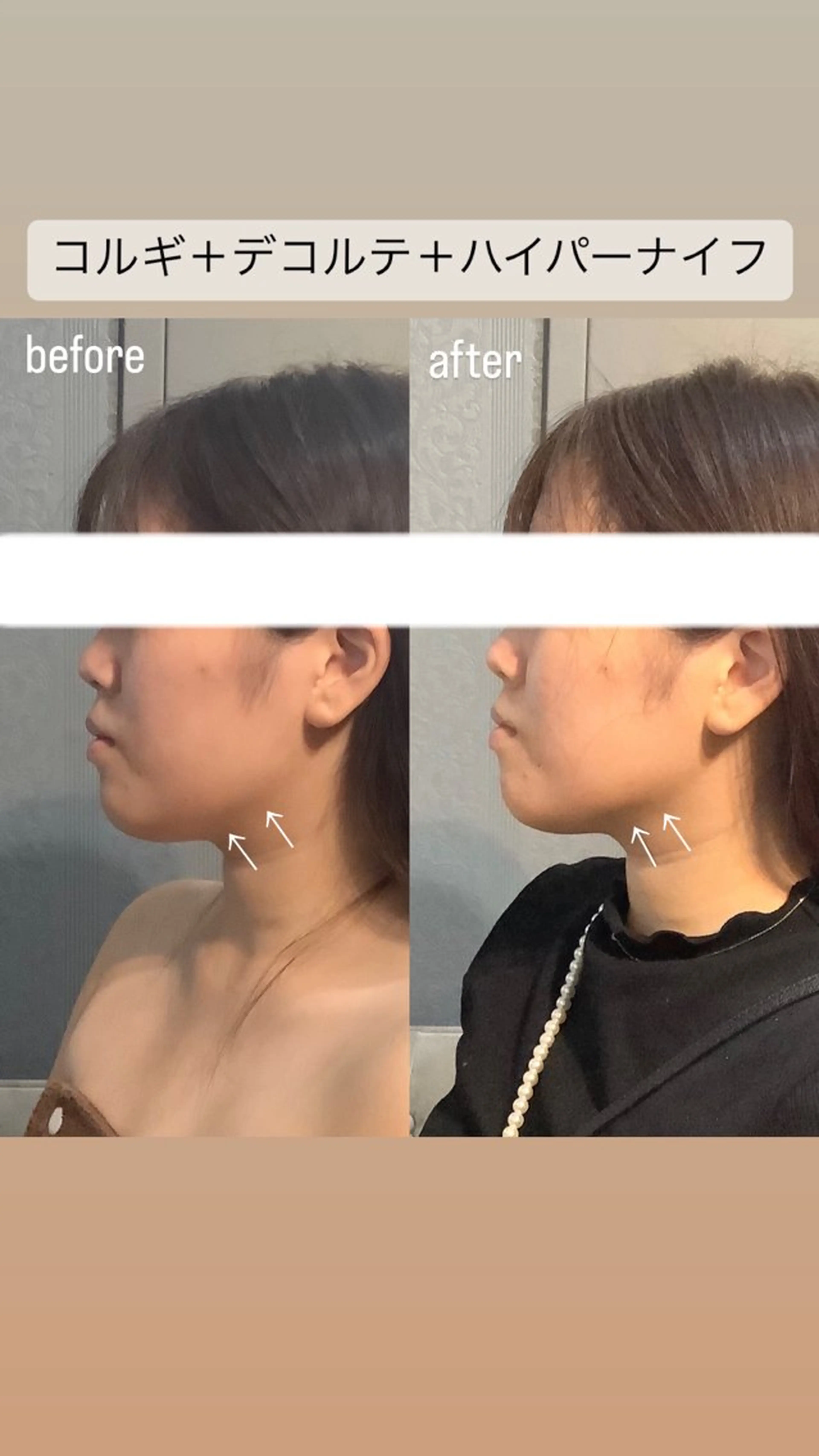 エステ リラク エステサロンino.colore'所属・小顔サロン ino.coloreのエステ・リラクイメージ