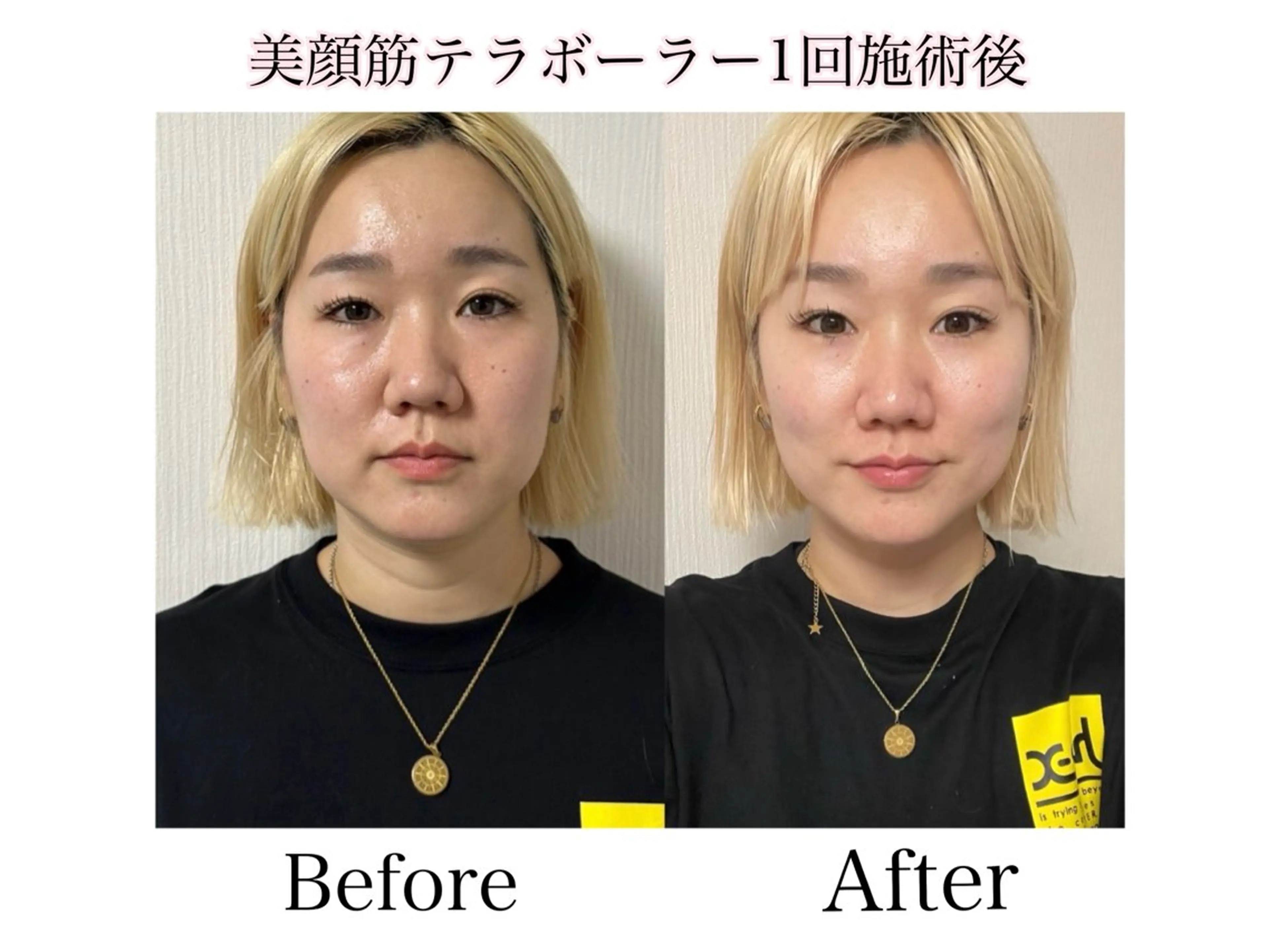 SALON MODS所属・HIKARU SALON MODSの眉毛・アイブロウイメージ