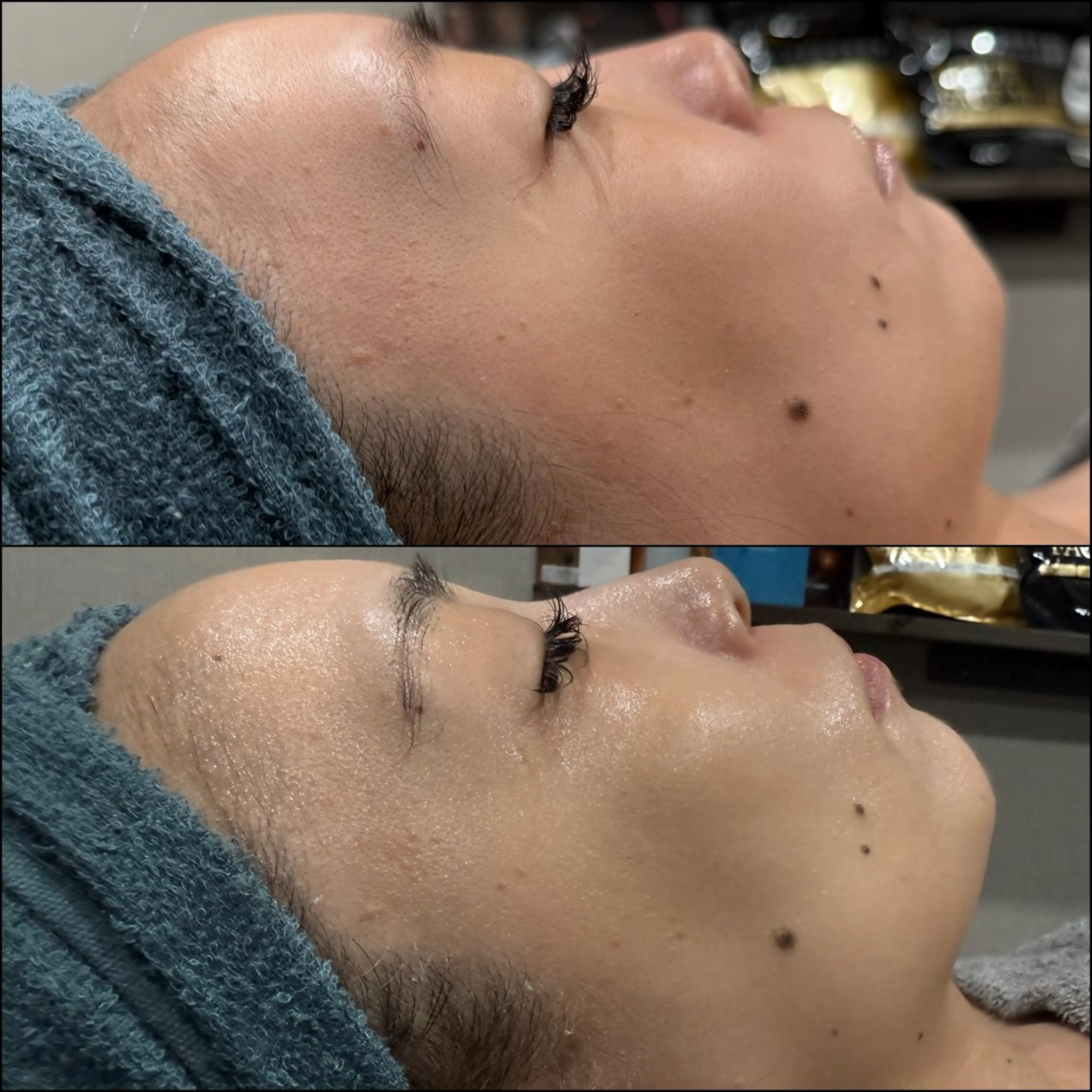 エステ LiZA エステティックサロンのエステ・リラクイメージ