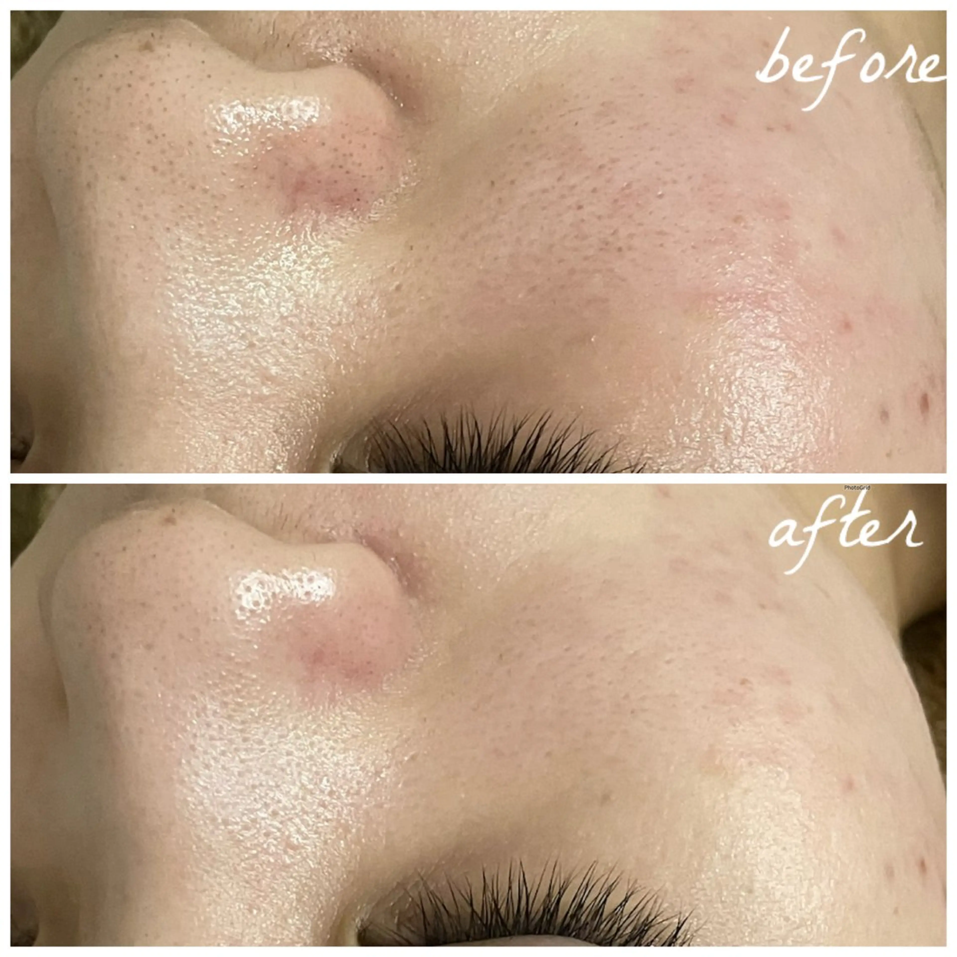 メンズ エステ メナード岐阜市茜部 杉浦のエステ・リラクイメージ