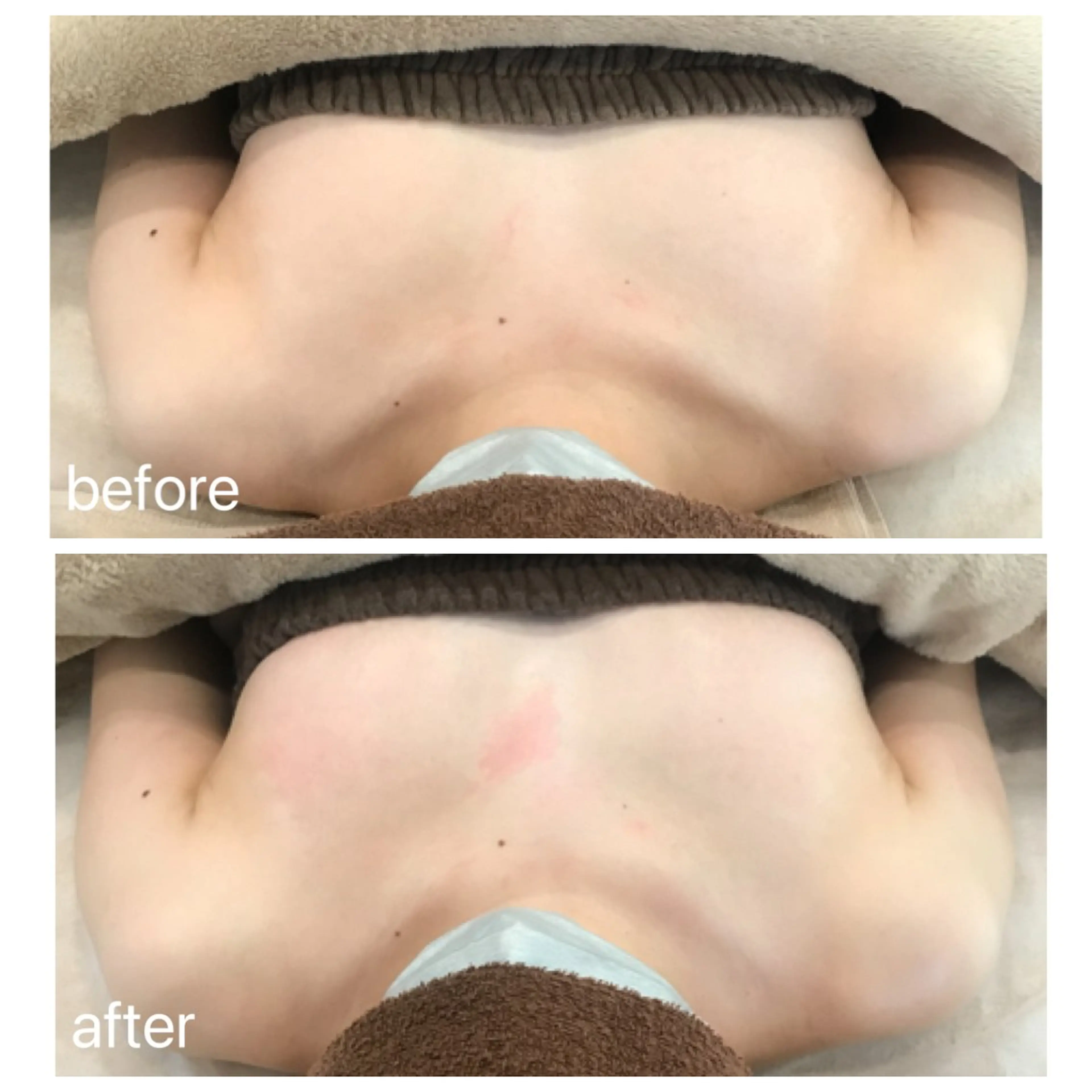 Rene 慢性疲労ケアサロンのエステ・リラクイメージ