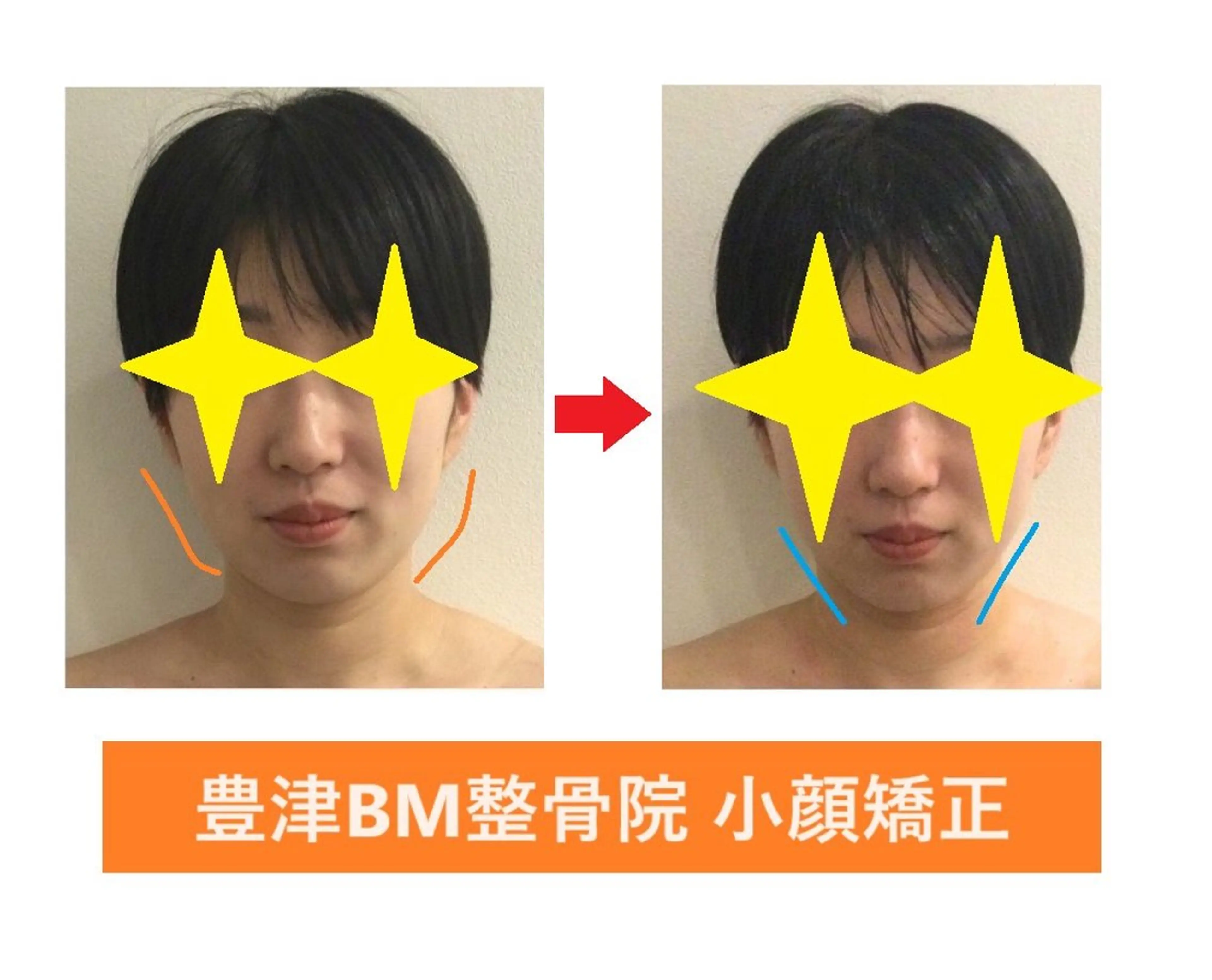 プチ小顔矯正​〜​あごライン-頬のラインスッキリ専門の写真