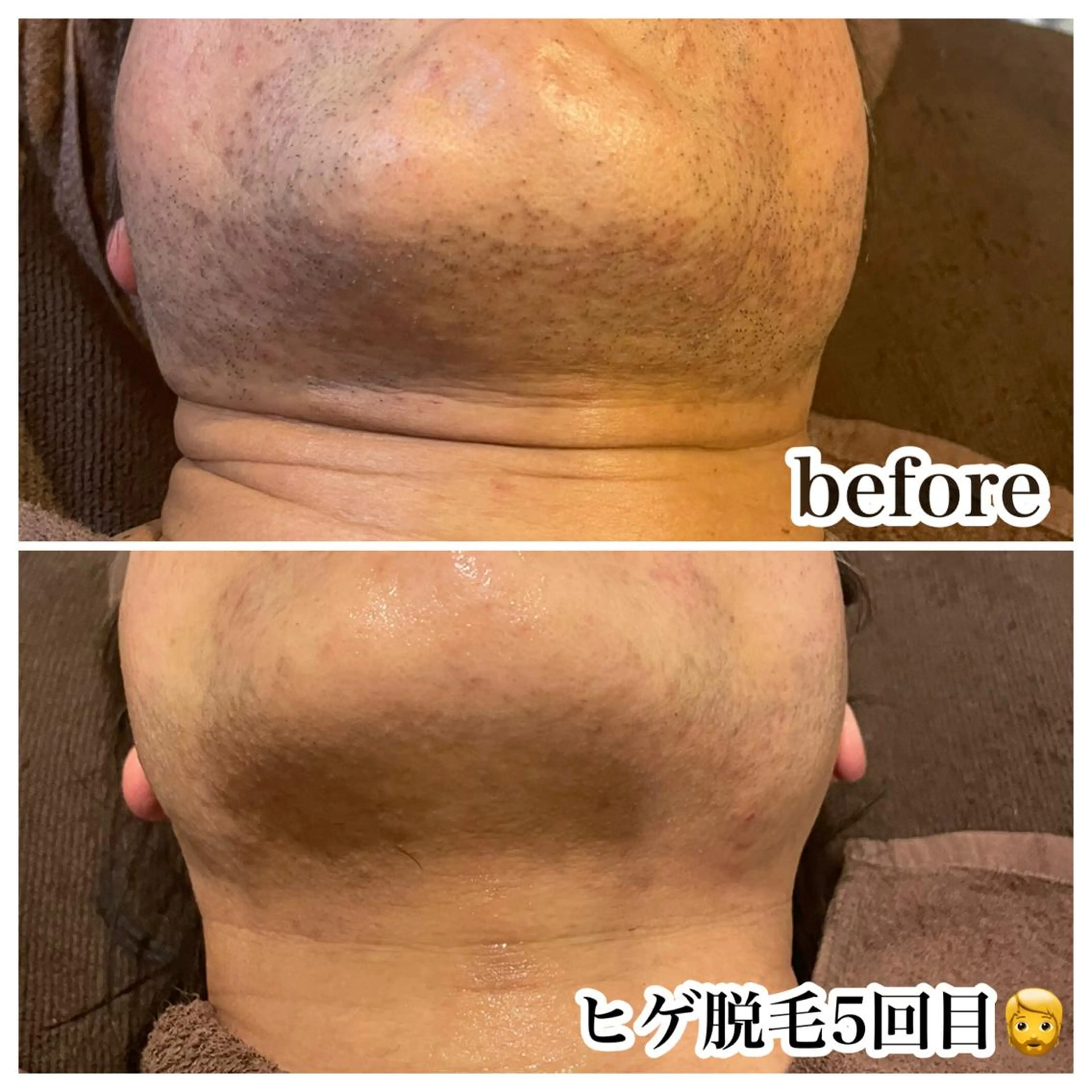 脱毛 浜野 恵美のエステ・リラクイメージ