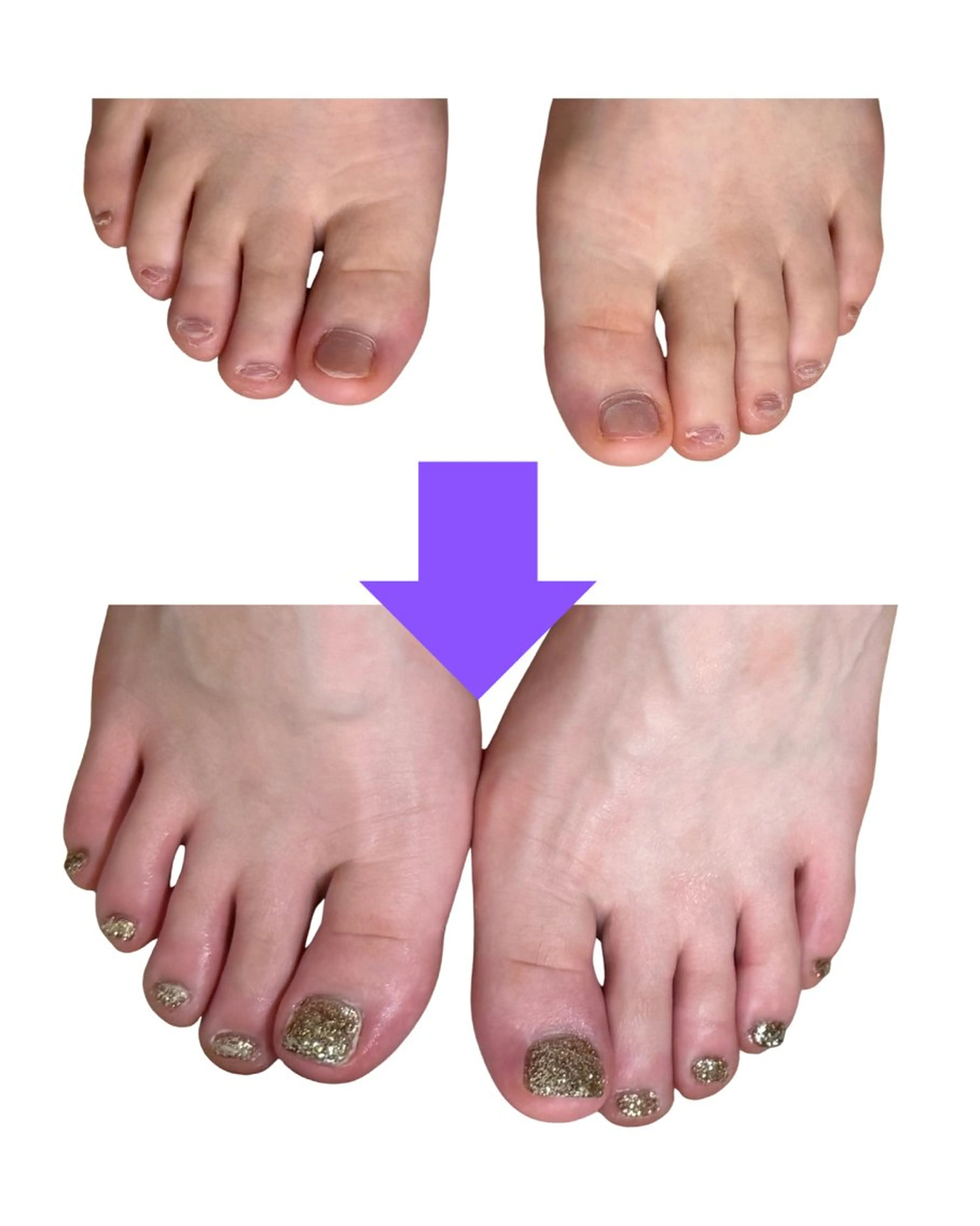 ネイル フットネイル ワンカラーネイル 深爪矯正専門店ネイルサロンKUU所属・ネイルサロン KUUのネイルデザイン