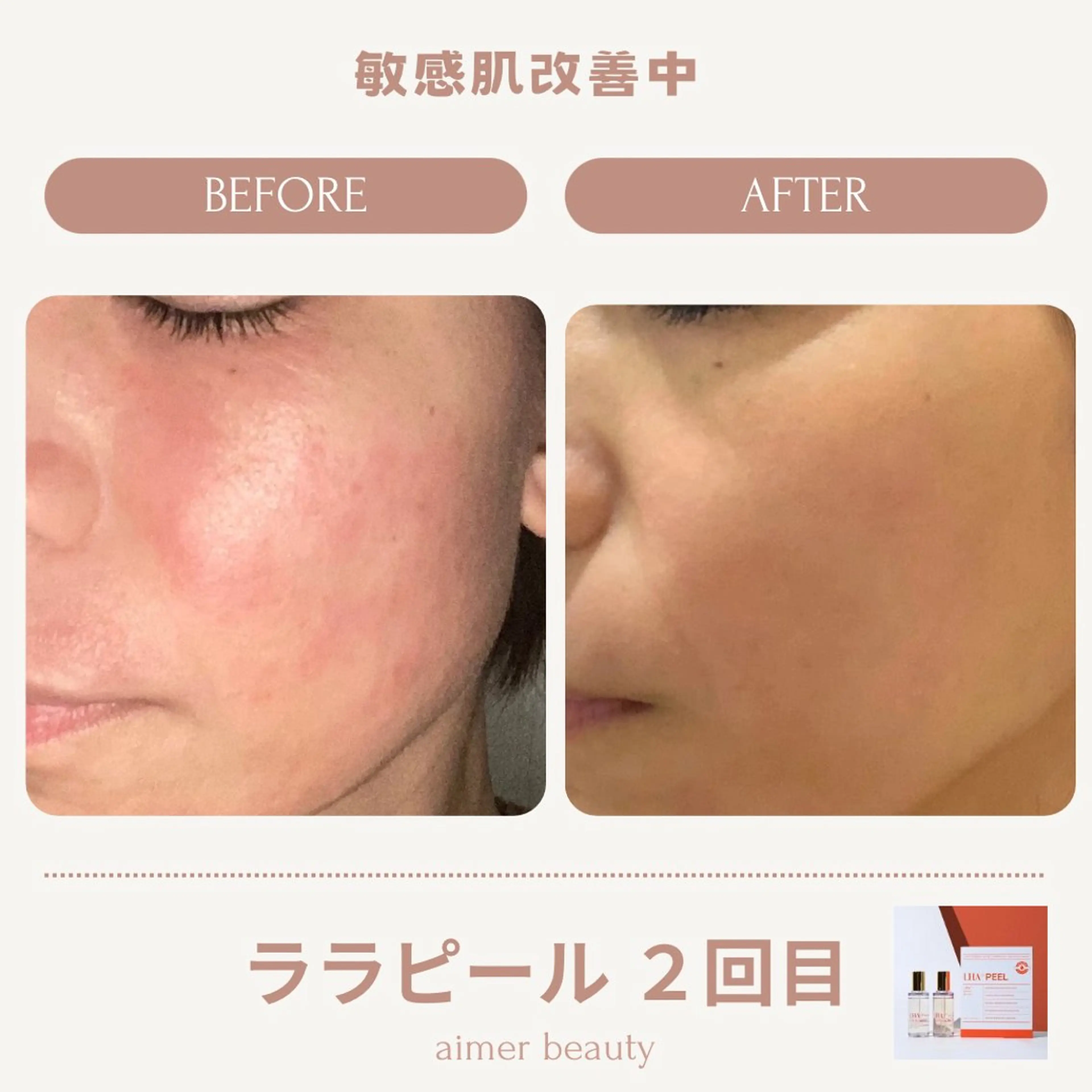 エステ aimer beautyのエステ・リラクイメージ