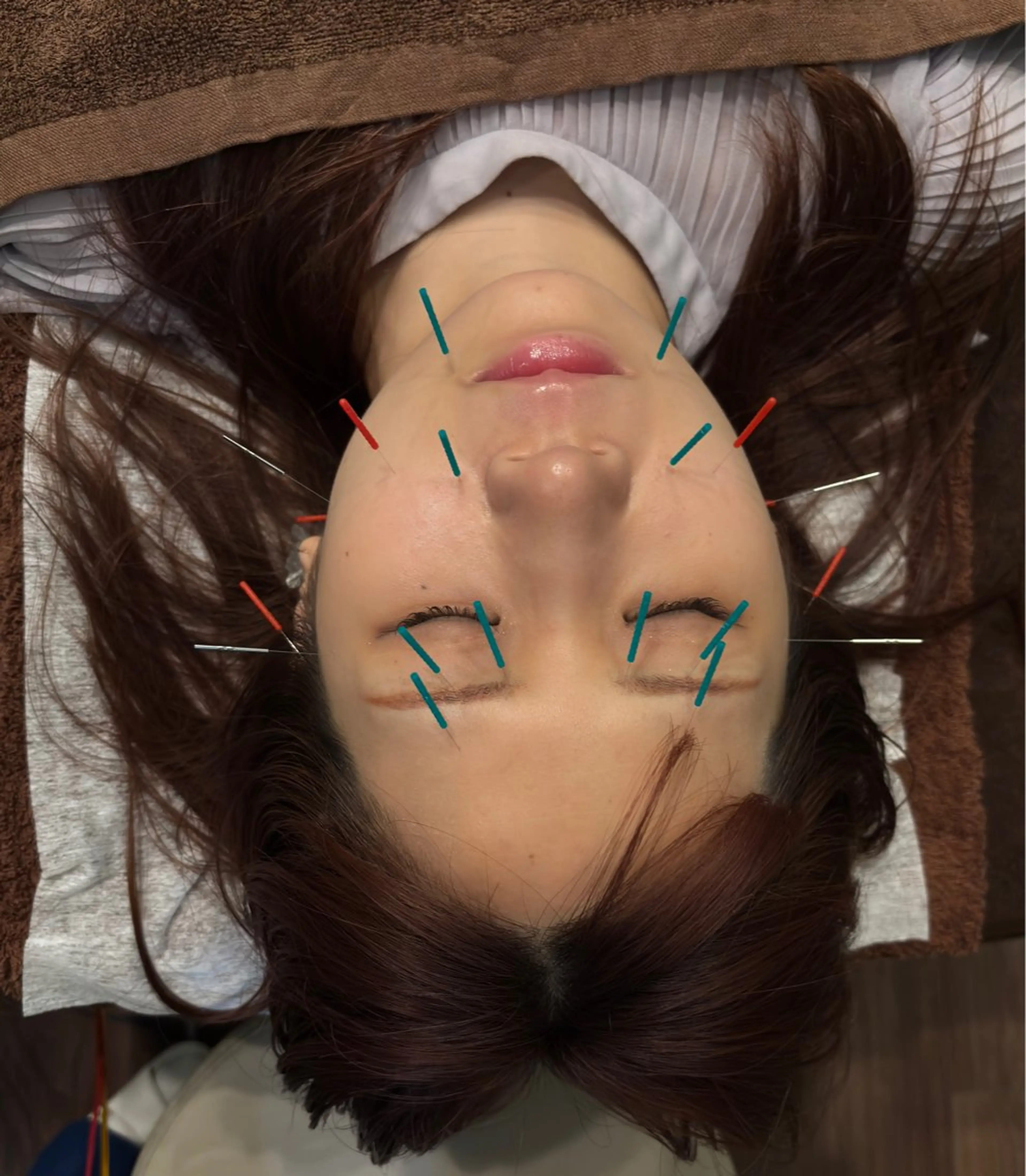 エステ リラク 小林整骨院本町 美容鍼roomのエステ・リラクイメージ