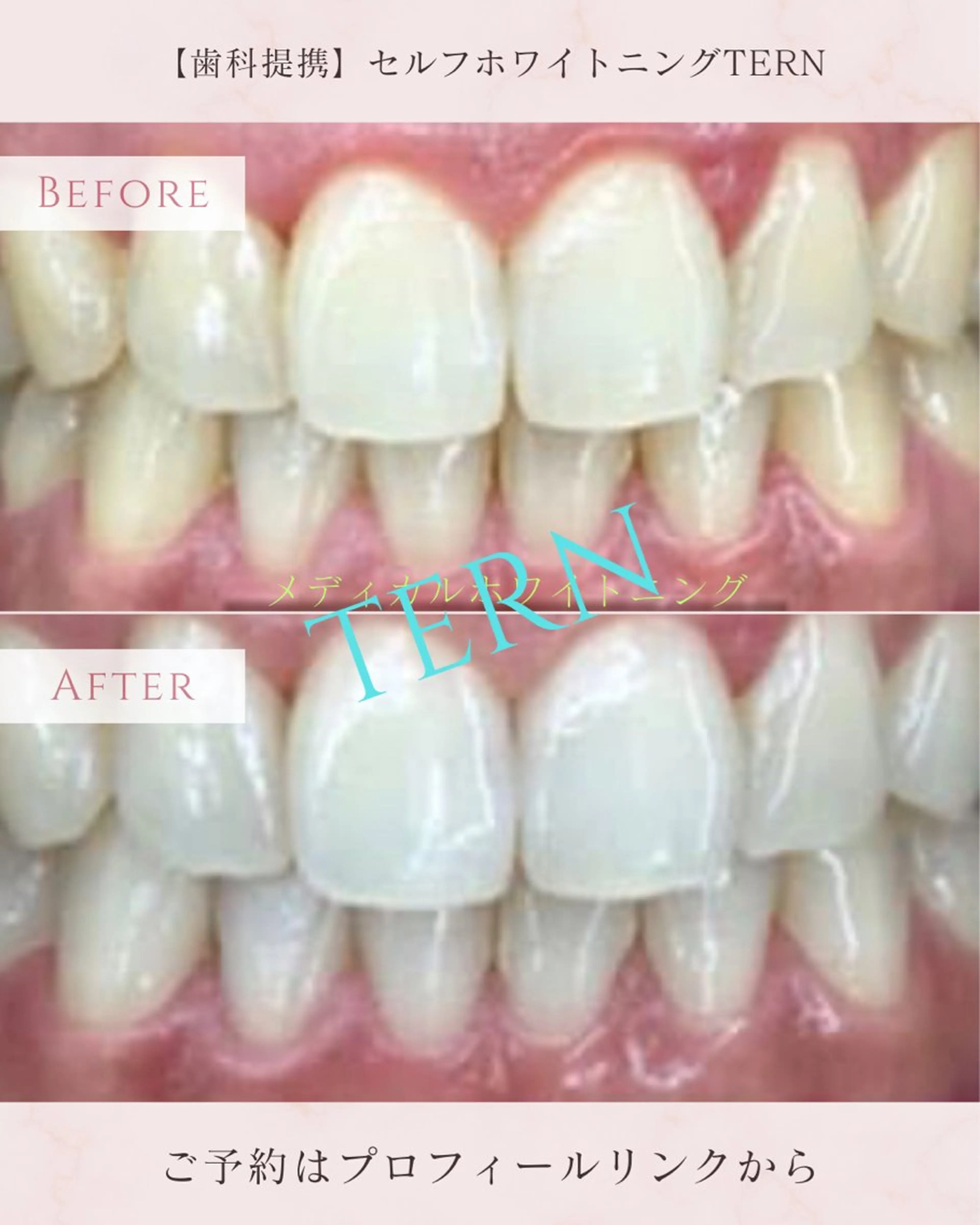 メディカルホワイトニングカウンセリングの写真