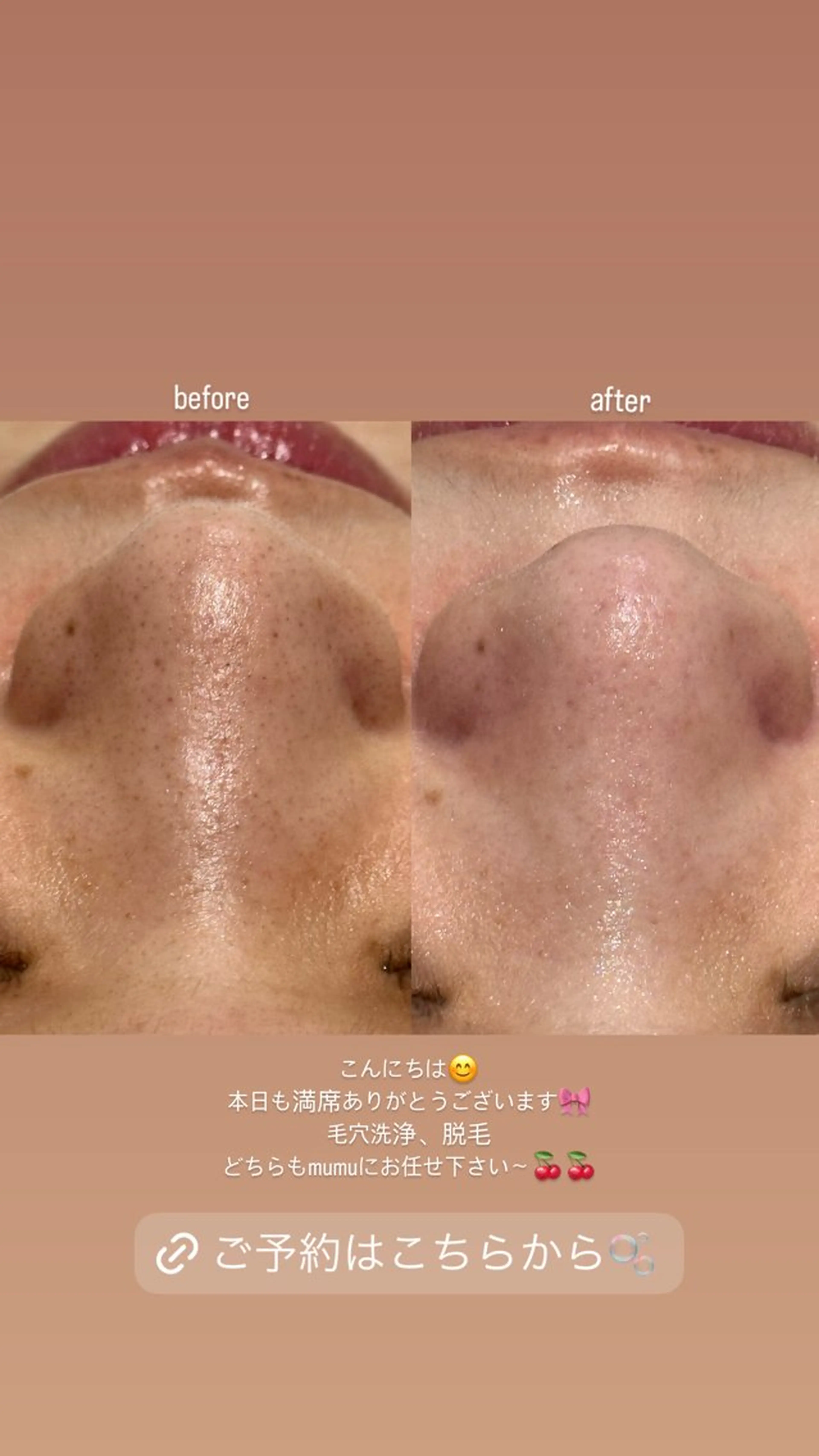 エステ mumu beautyのエステ・リラクイメージ