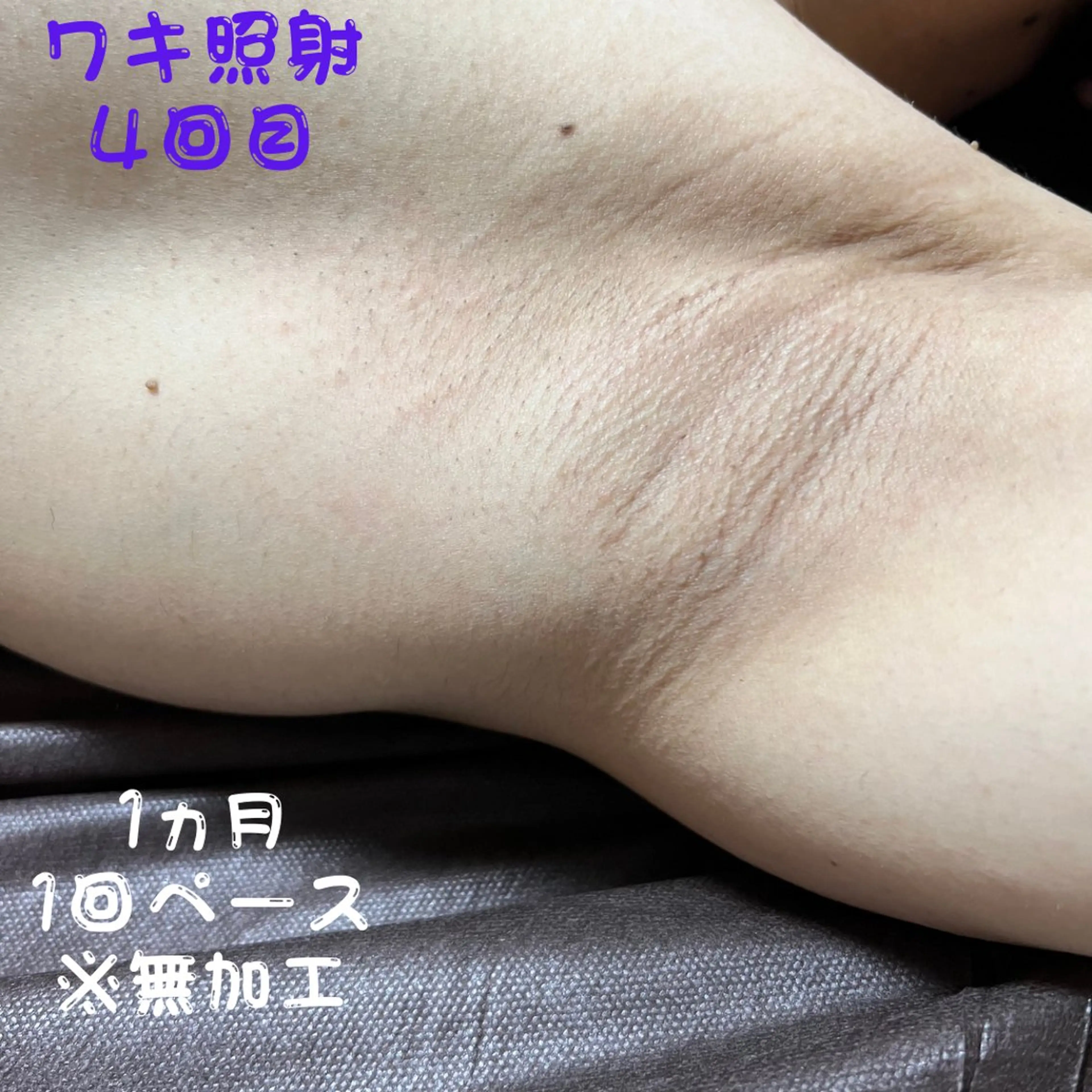 メンズ キッズ 脱毛 メンズ脱毛 FELISSE【フェリッセ】所属・メンズ脱毛フェリッセ /男女🆗キッズ🆗のエステ・リラクイメージ