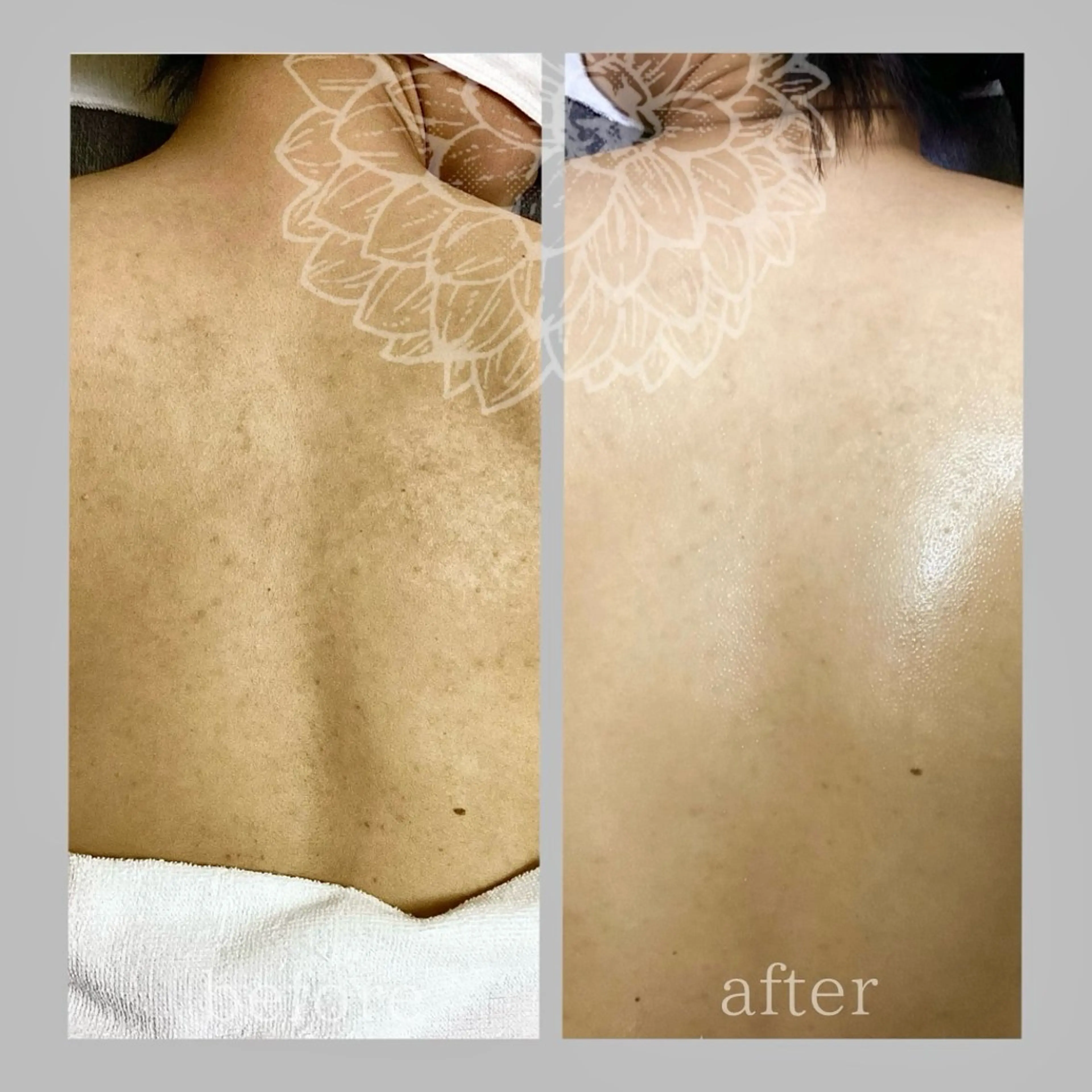 salon DAHLIA所属・salon DAHLIAのエステ・リラクイメージ