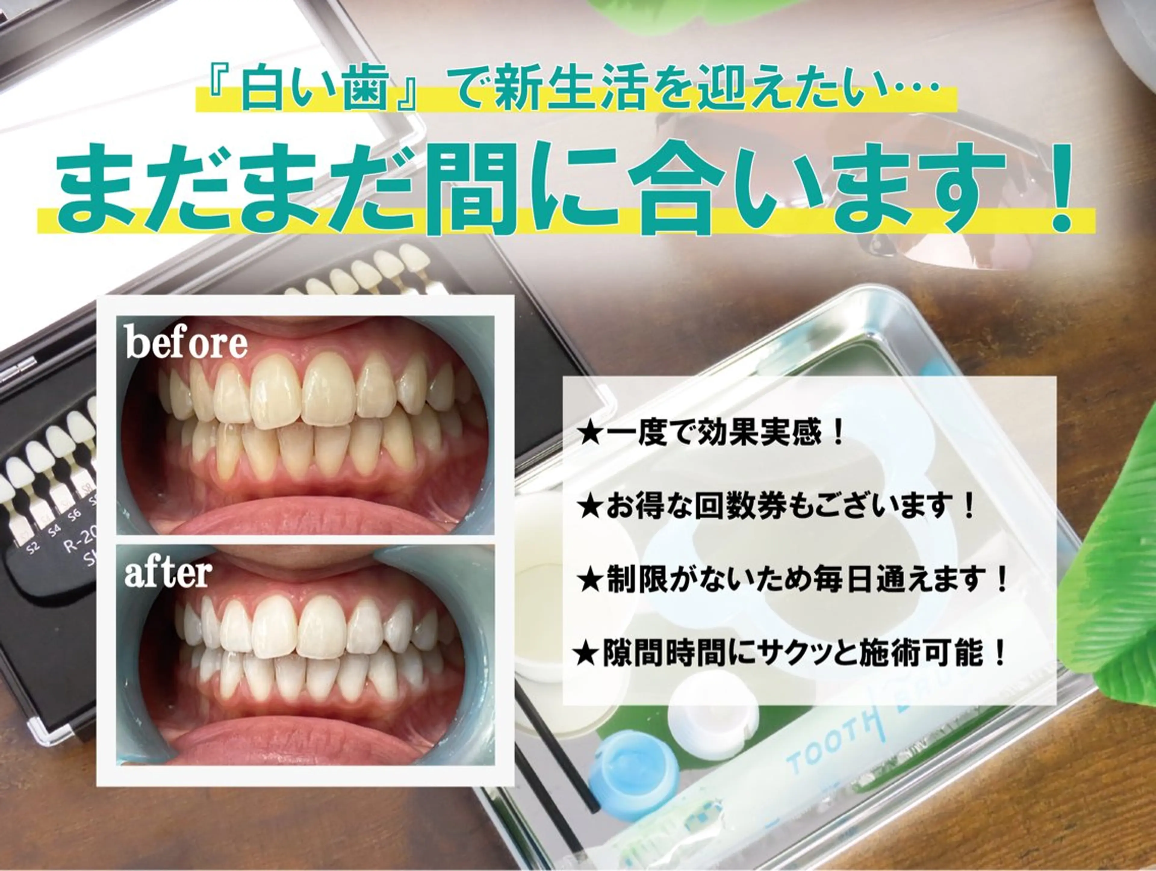 その他 self whitening salon 4618所属・ホワイトニングサロン 4618のその他イメージ