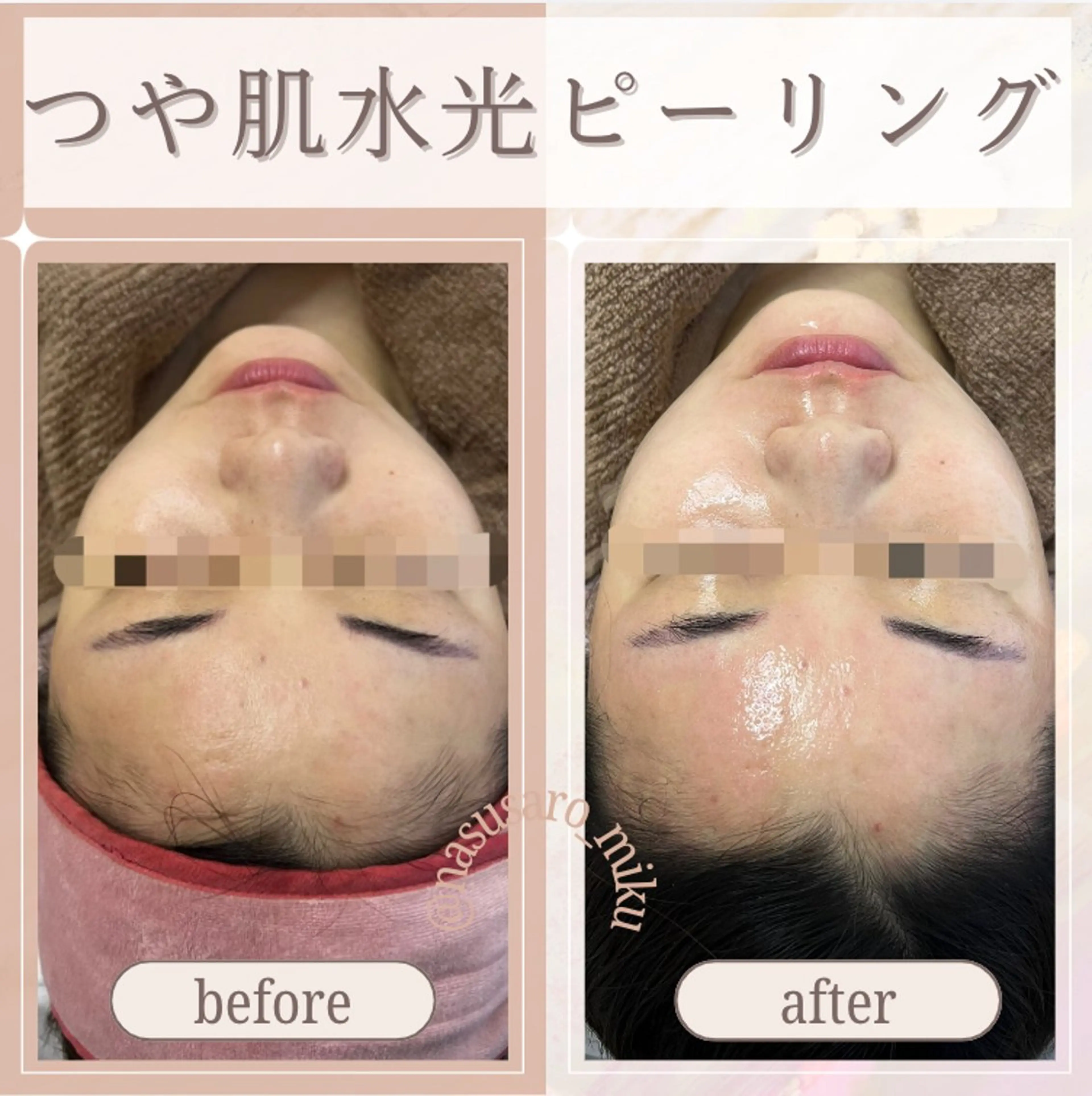 🎀韓国式肌改善🎀 Miku🇰🇷💎のその他イメージ