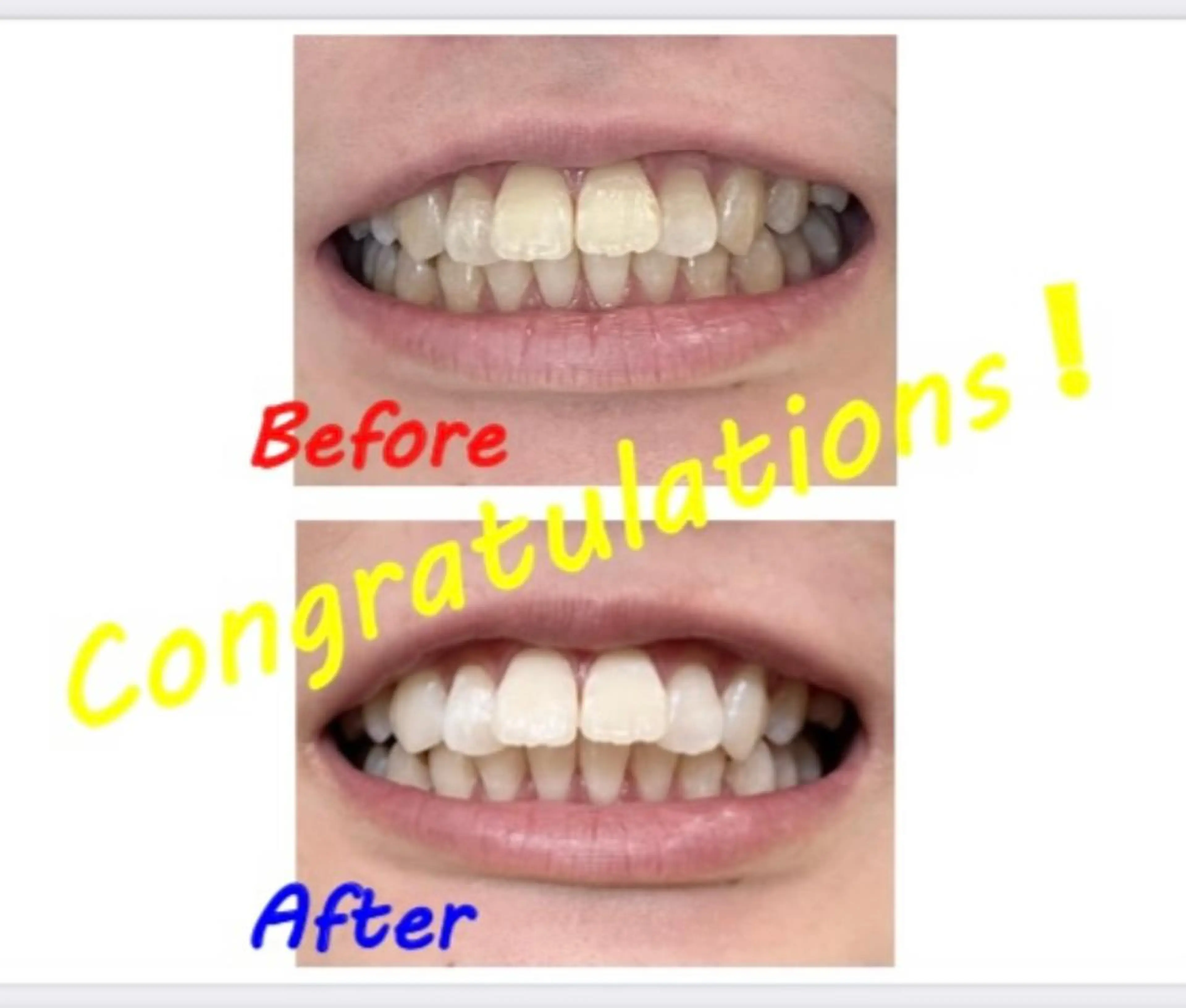 その他 セルフホワイトニングサロン　ラヴィアン所属・ホワイトニングサロン La vie enのその他イメージ