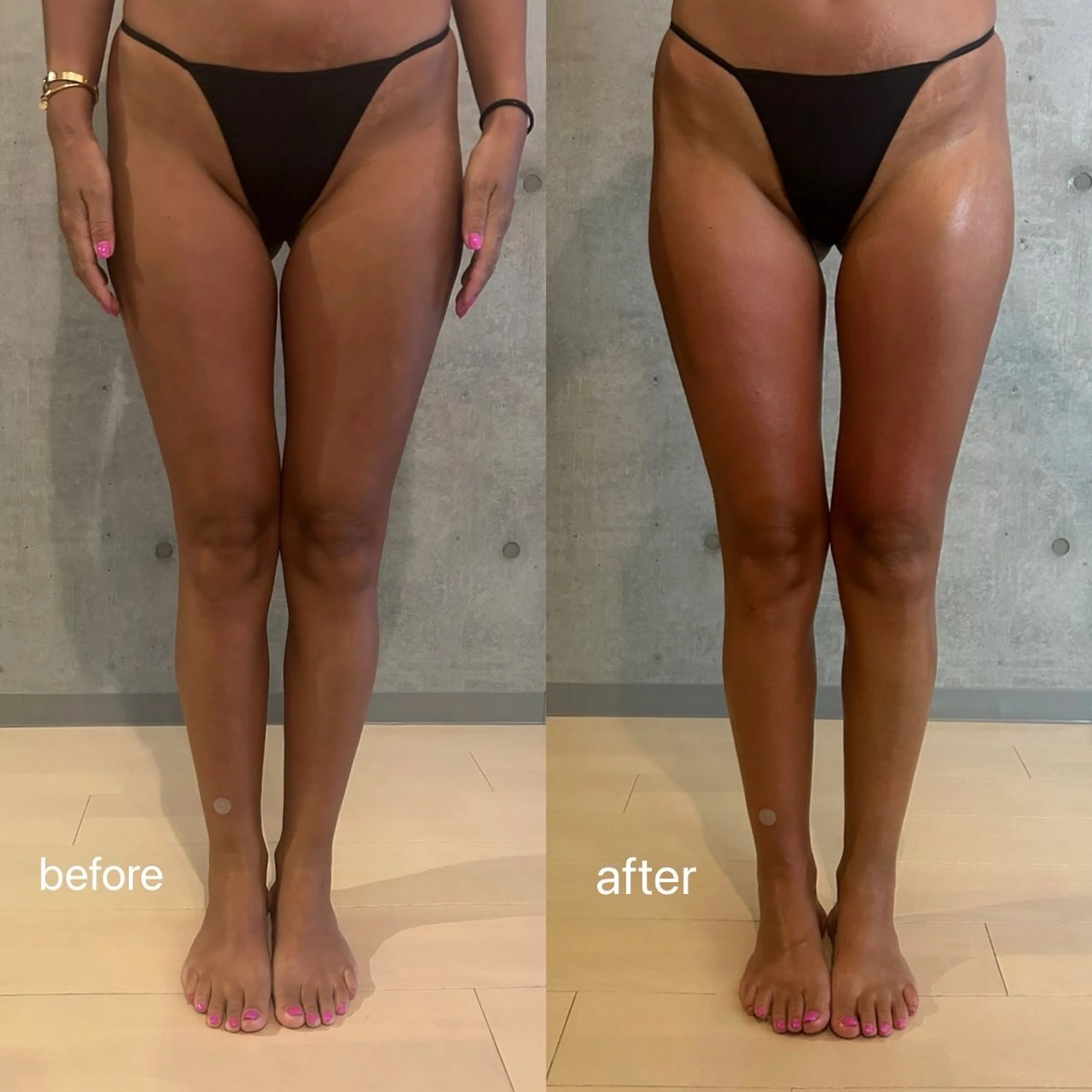 肥後橋INDIBA Salon　Calmのその他イメージ