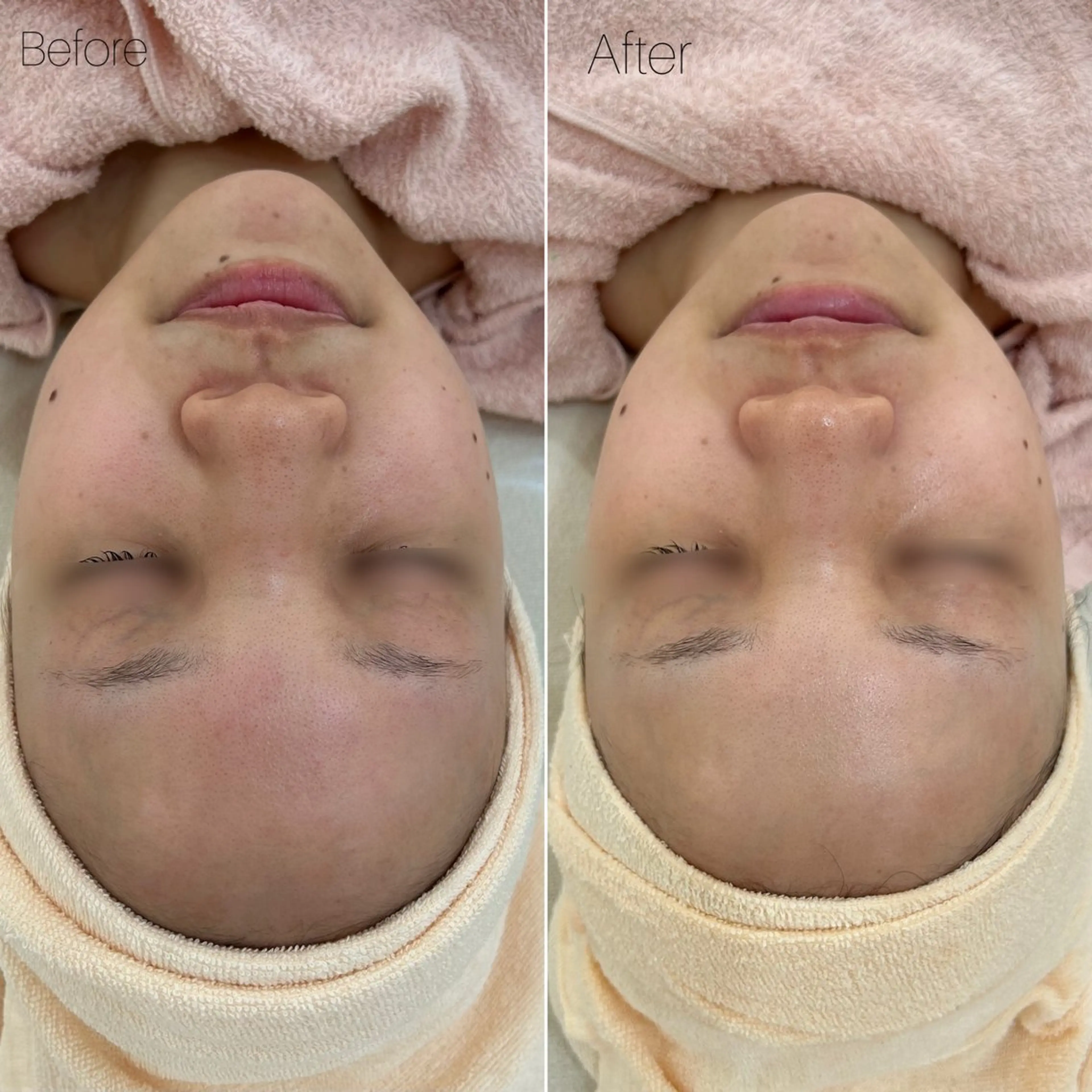 エステ 〈etre〉トータルビューティーサロン所属・etre - 韓国肌管理 -のエステ・リラクイメージ