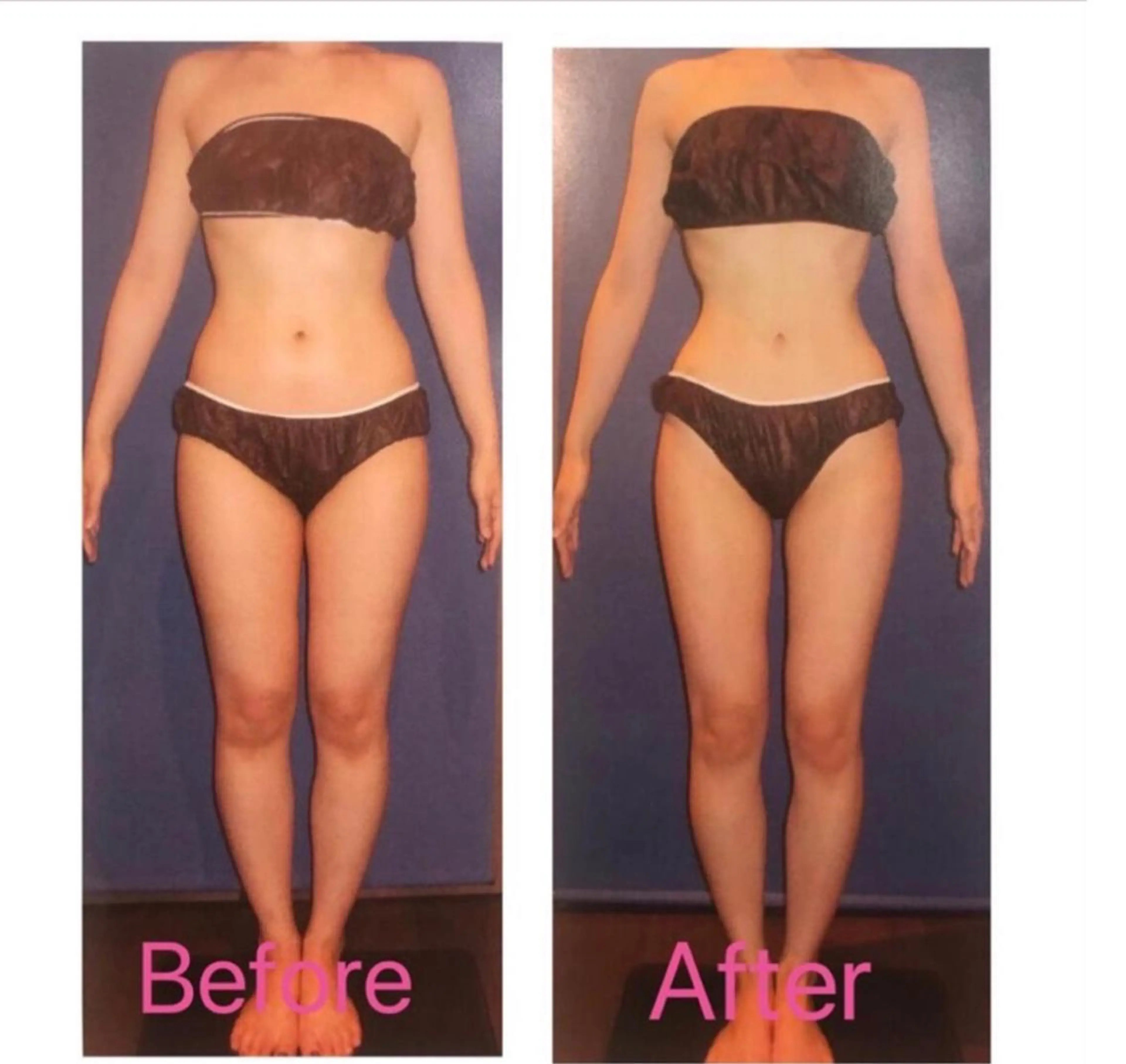 エステ BELINDA銀座店 ✨痩身エステサロン✨のエステ・リラクイメージ