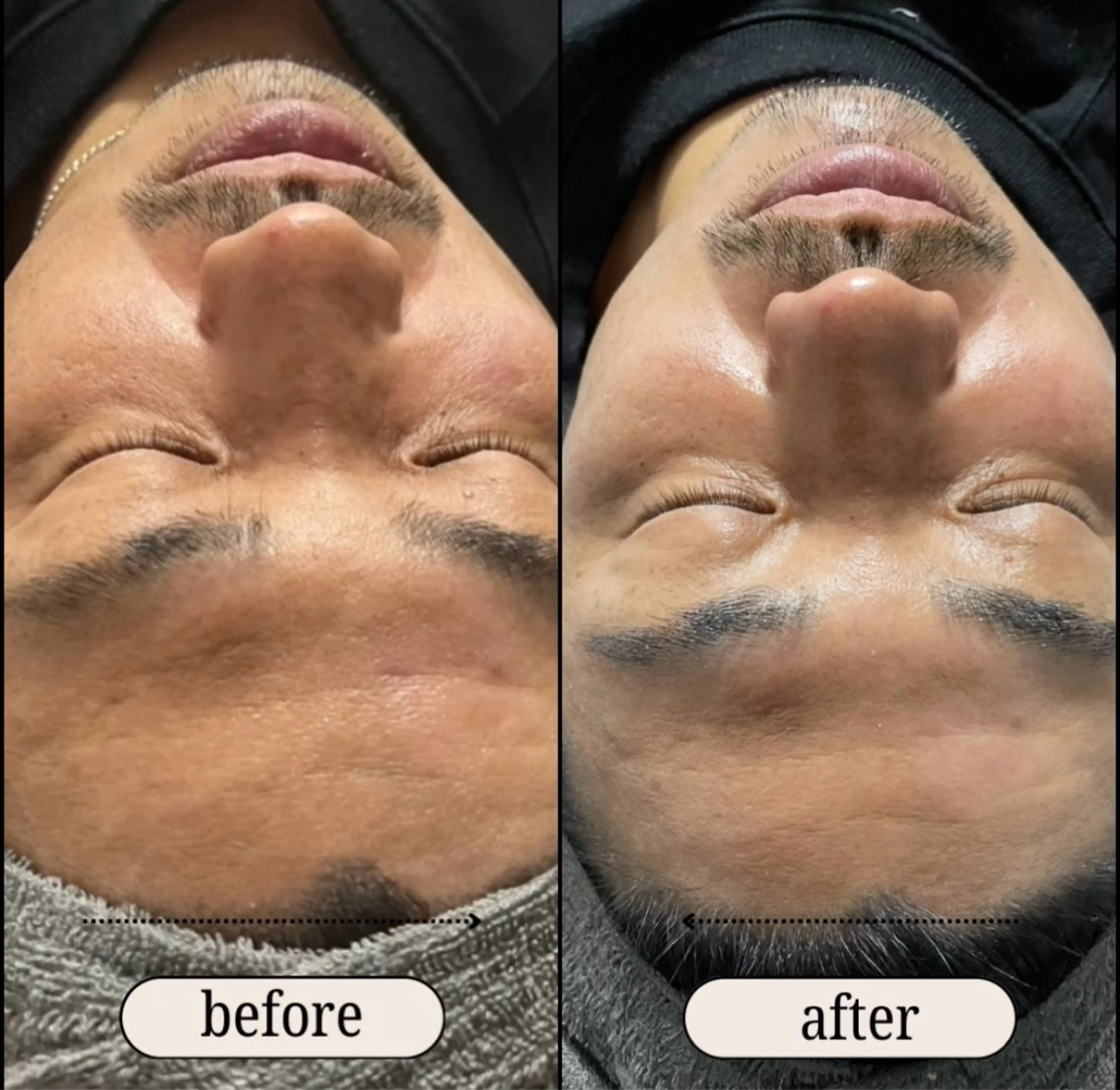 メンズ ele"ハーブ ピーリング 専門店のエステ・リラクイメージ