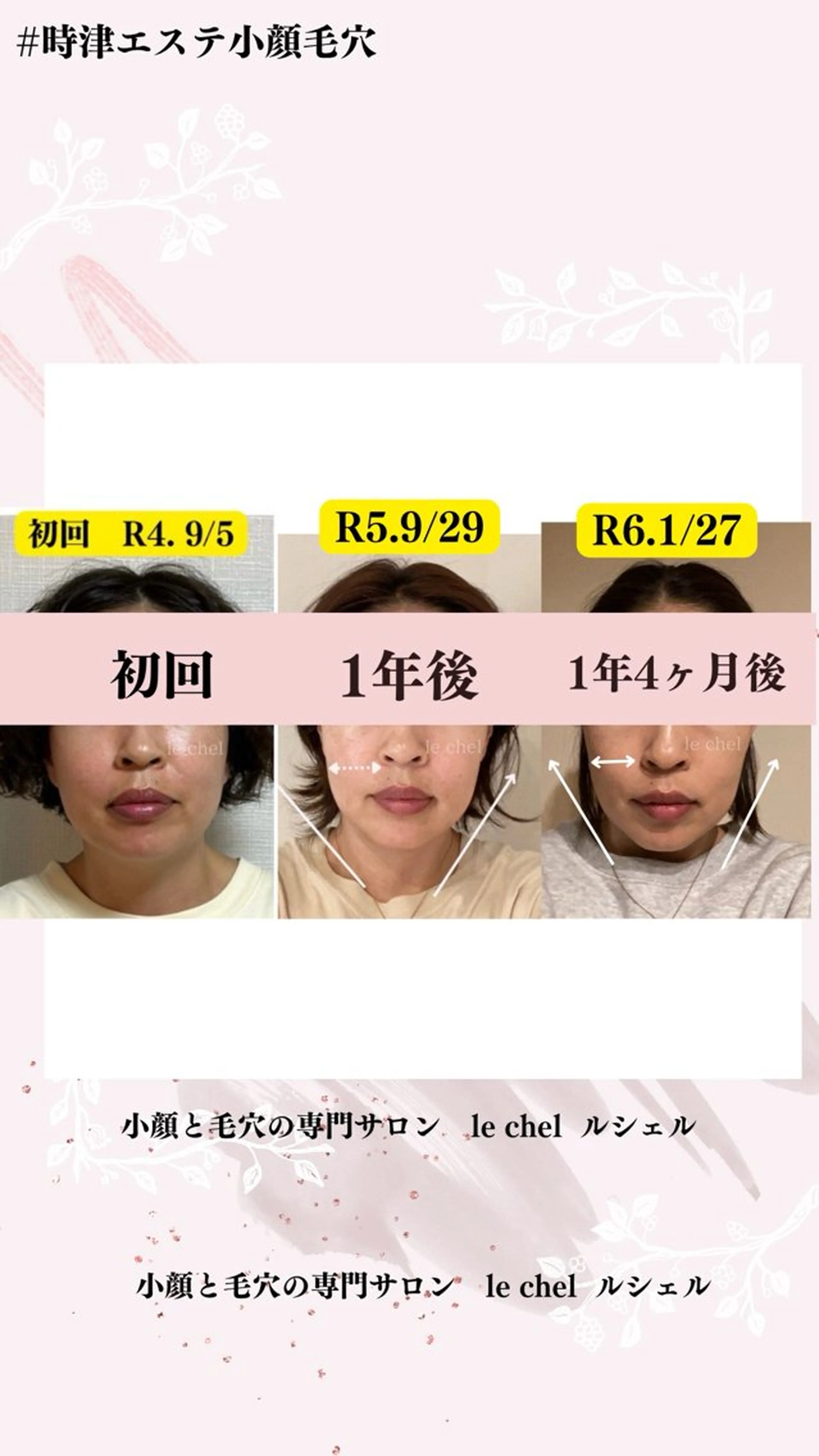 小顔・毛穴専門サロン　le chel 　ルシェル所属・小顔・毛穴専門 ルシェルのエステ・リラクイメージ