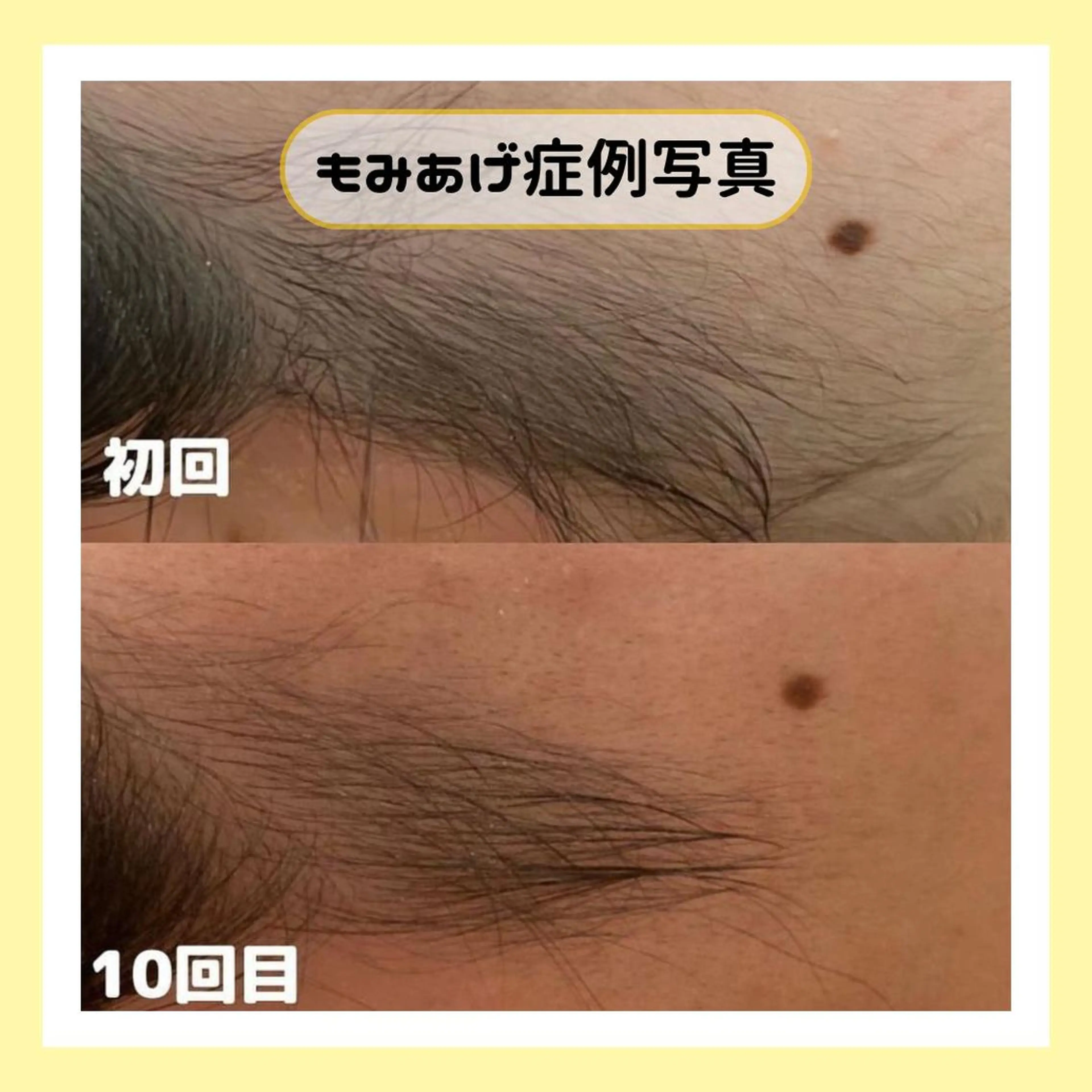 金山/脱毛/美肌 ULULUのエステ・リラクイメージ