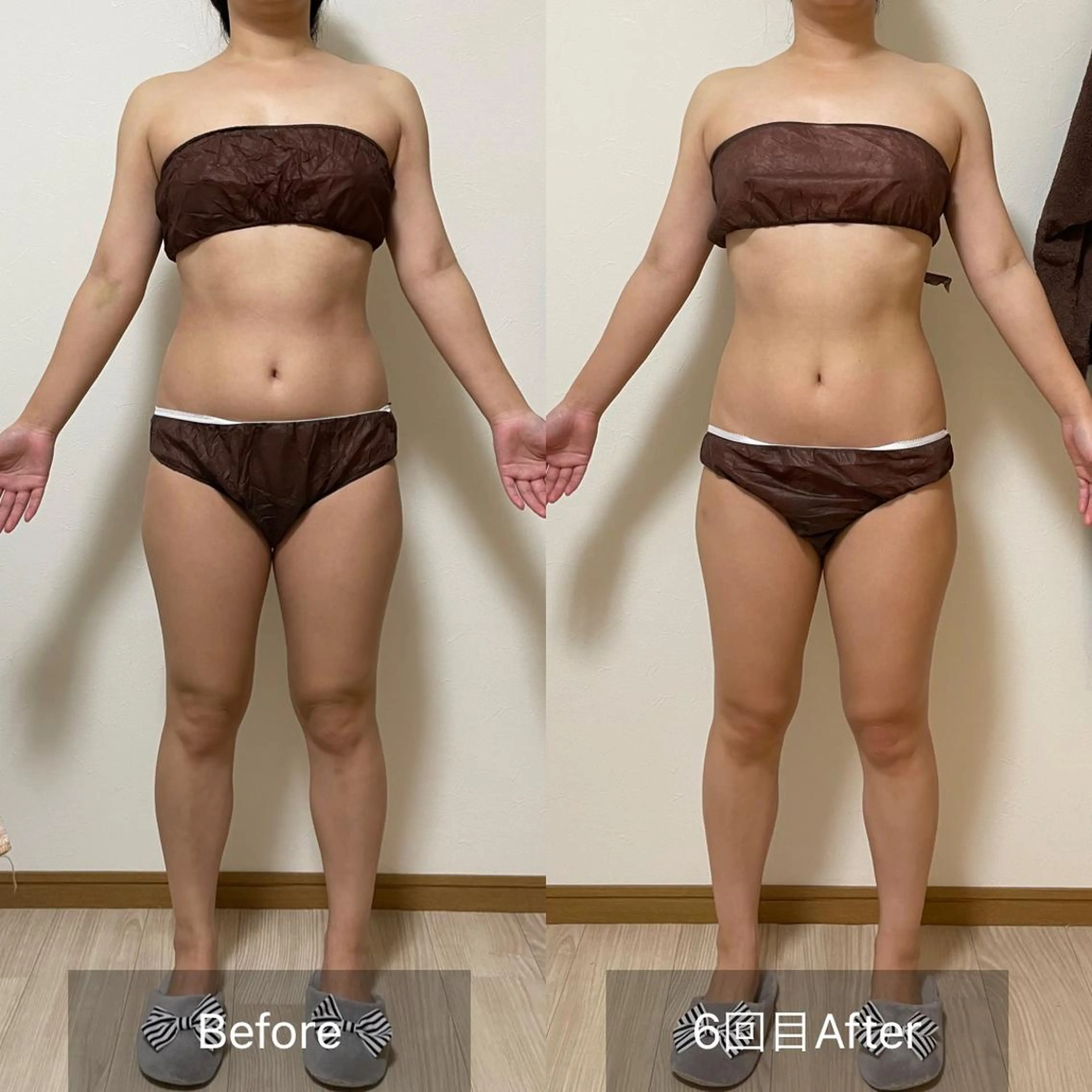 未病ケアサロン　EMINY所属・未病ケアサロン EMINY☺︎勝俣のエステ・リラクイメージ