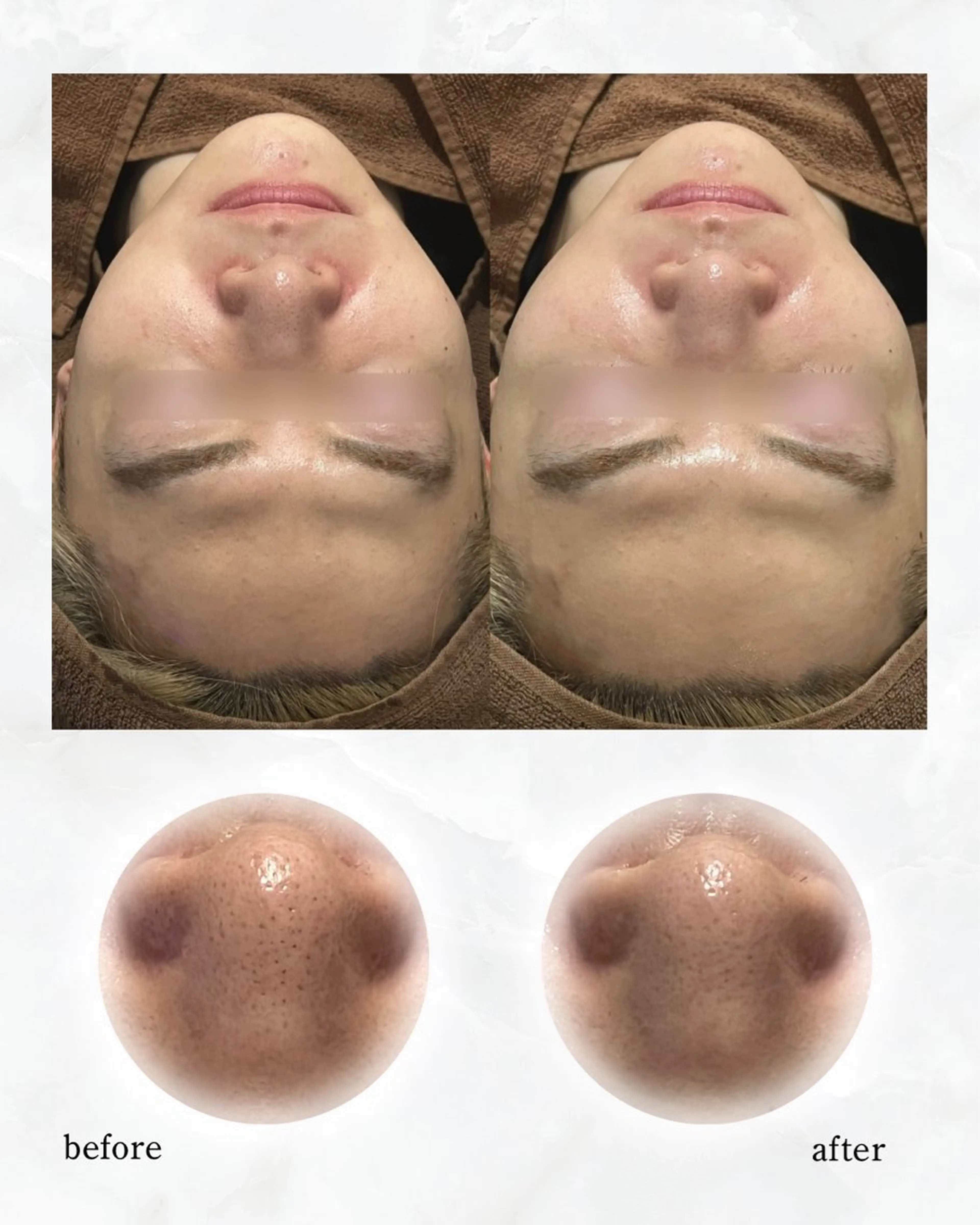 ENCHANT Kaede/肌質改善のその他イメージ