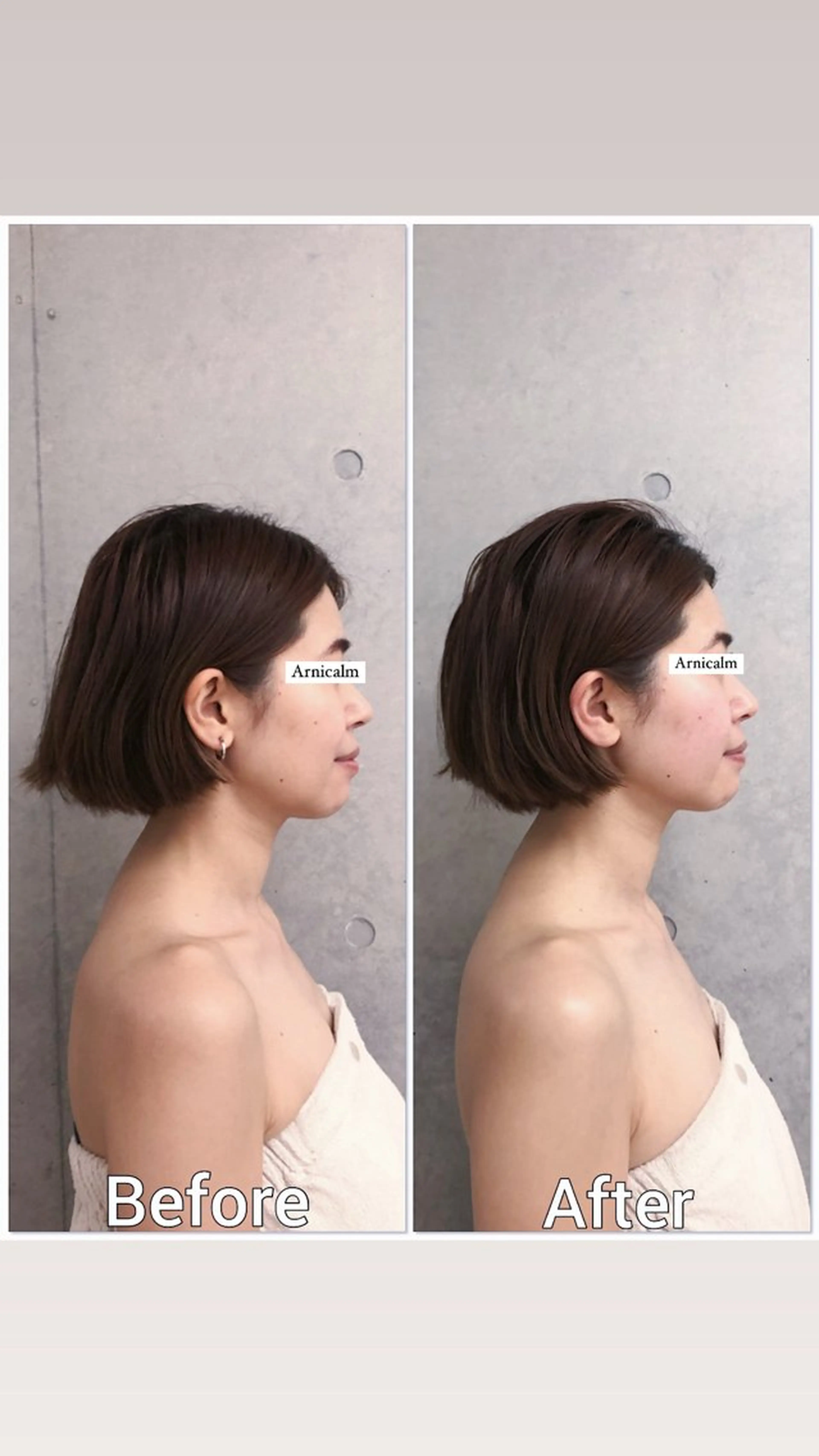 エステ ハーブピーリング 肌再生ピーリング/のエステ・リラクイメージ