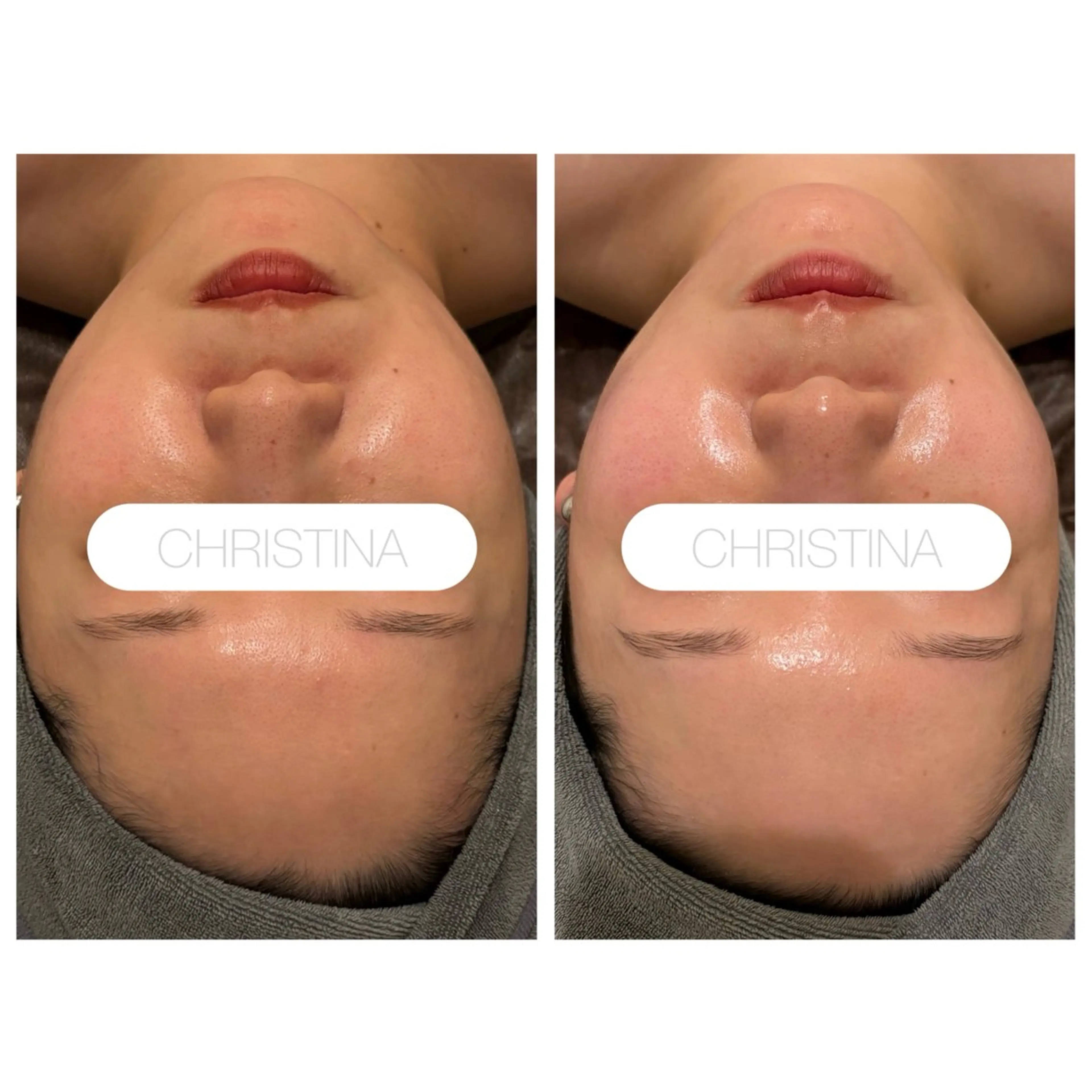 小顔コルギ ☆表参道/外苑前のエステ・リラクイメージ